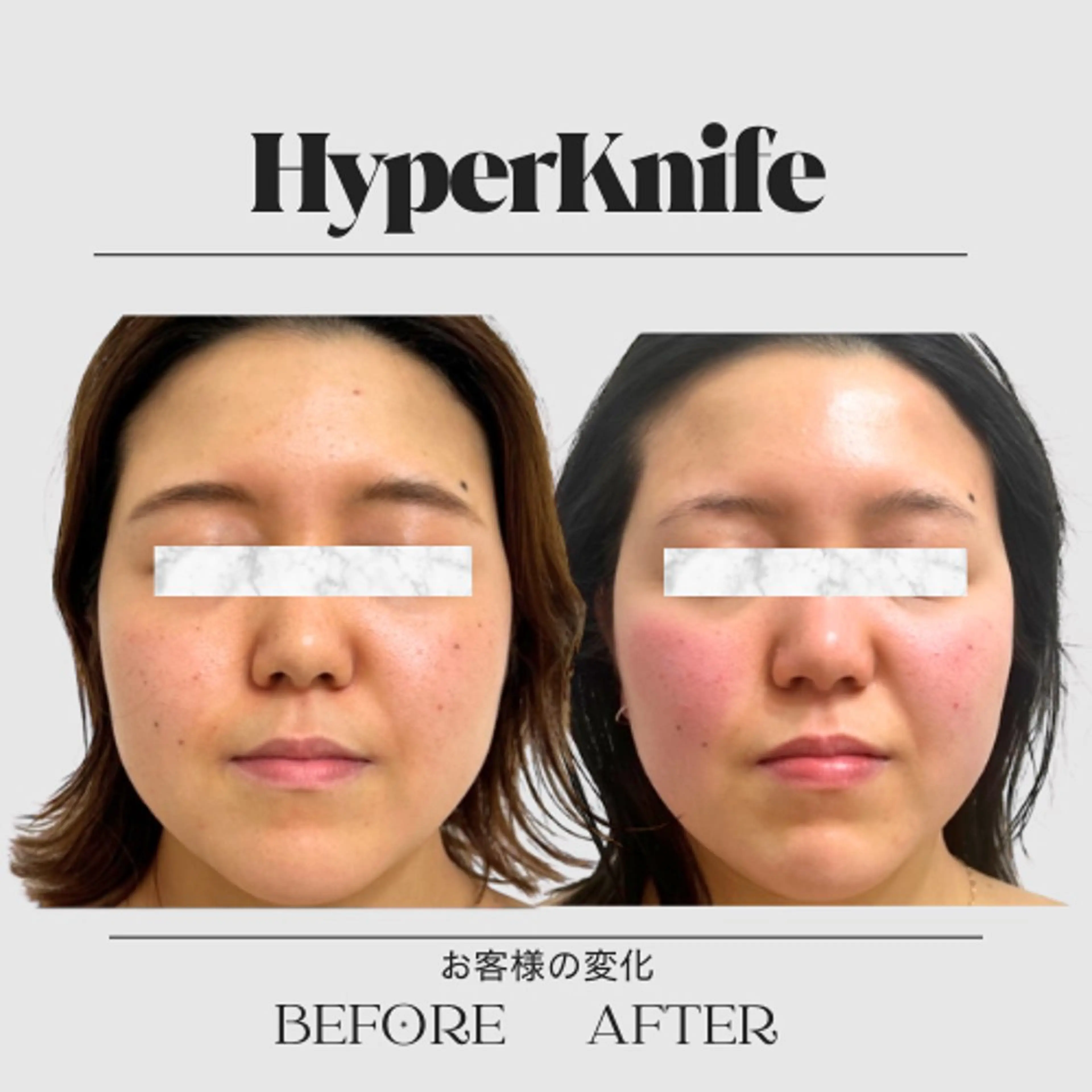 エステ aimer 服部のその他イメージ