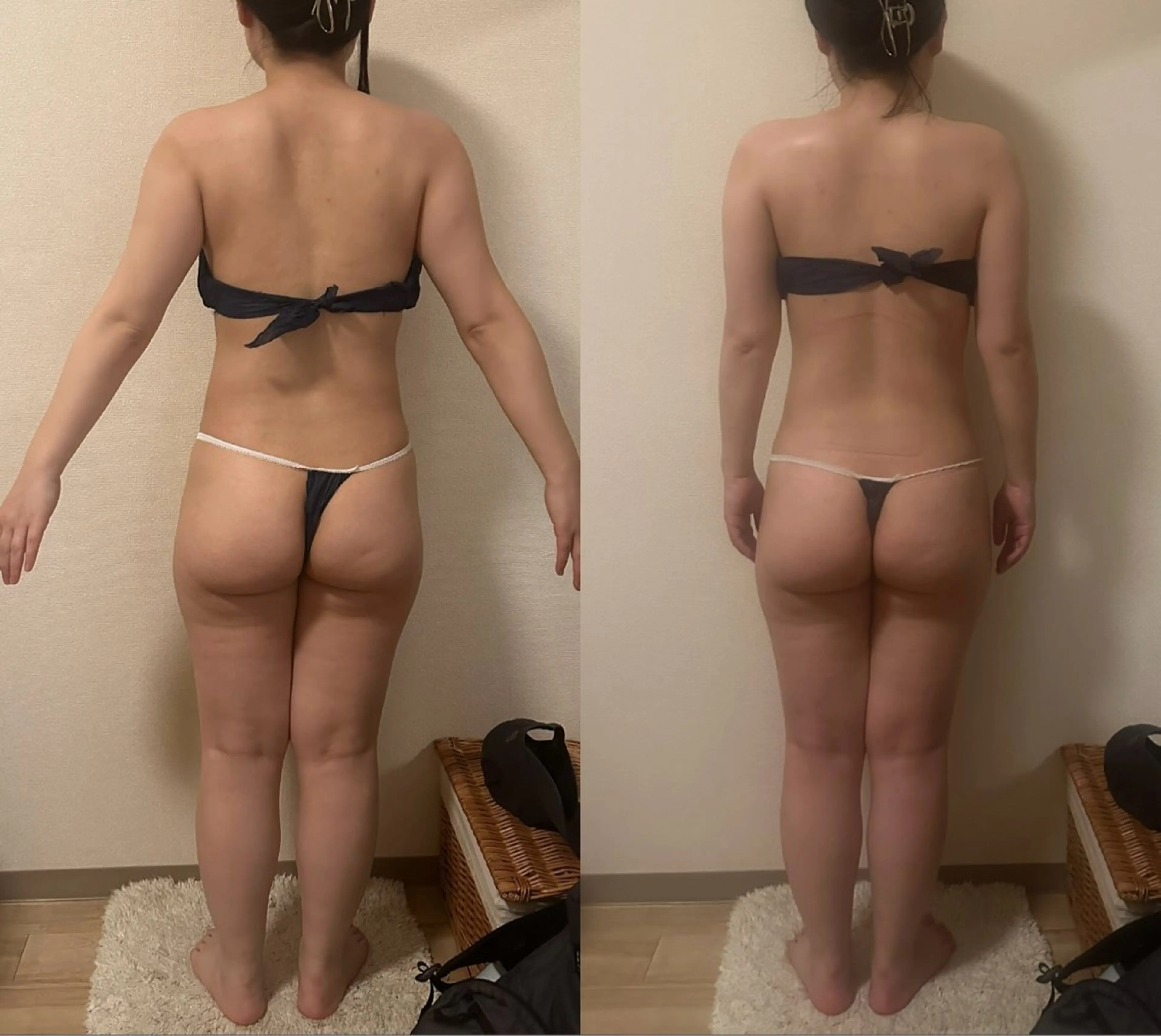 🆕体質改善サーモケア✨120分✨インディバ最新機種同等ハイスペック深部加熱マシーンの写真