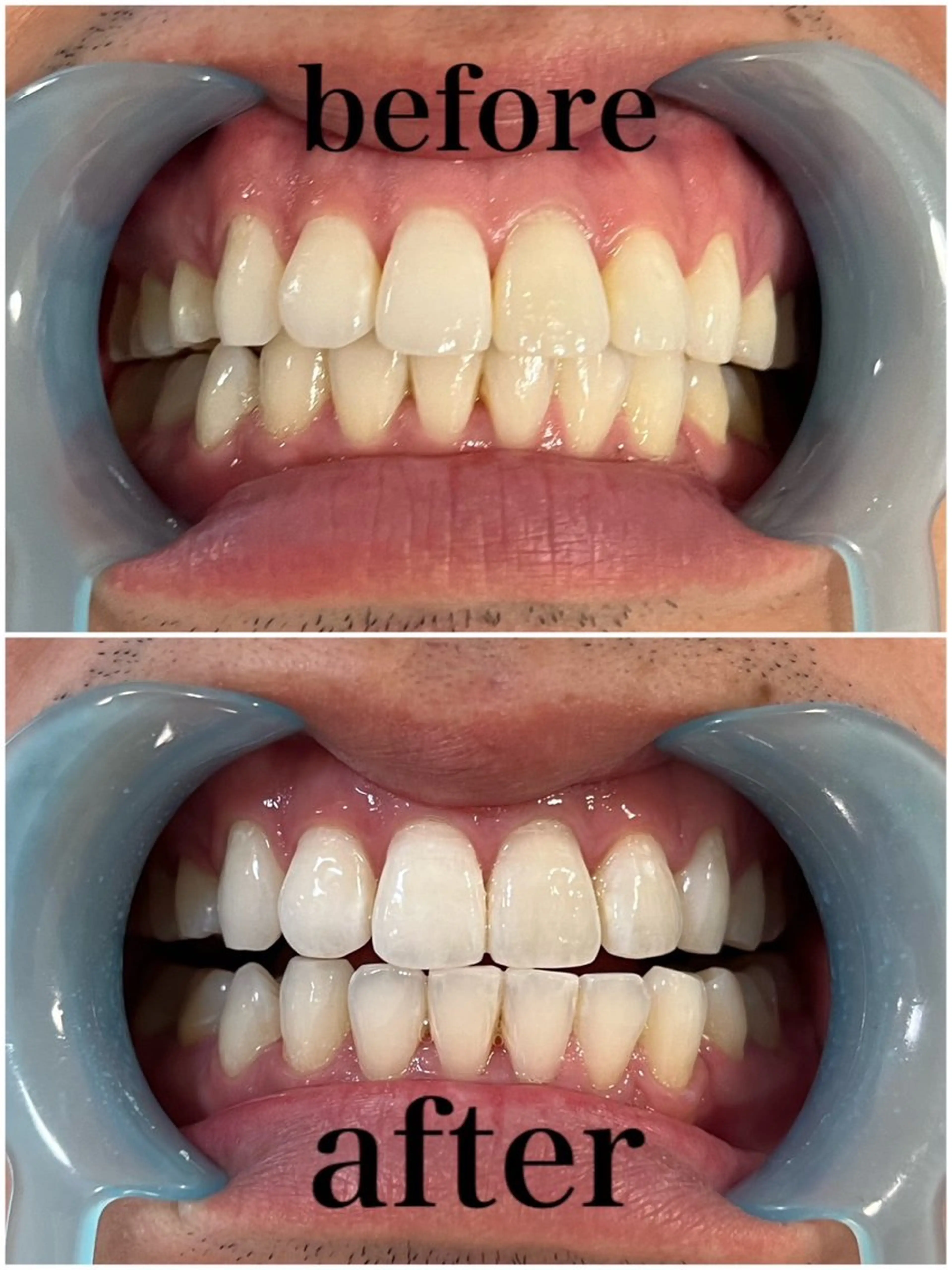 WHITENING ハウスのマツエク・マツパデザイン