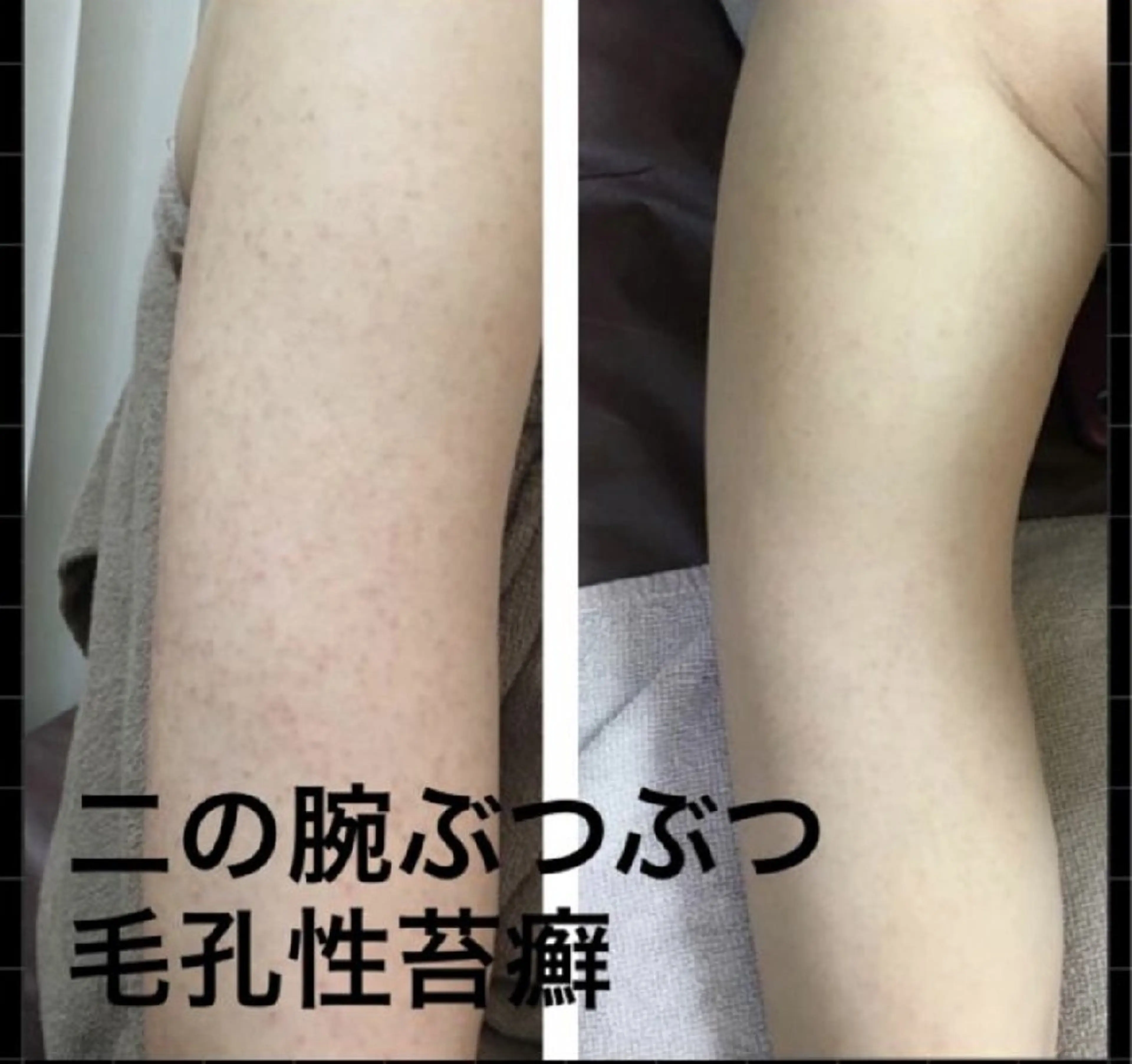 エステ ハーブピーリング専門 COCO.梅田中津のエステ・リラクイメージ