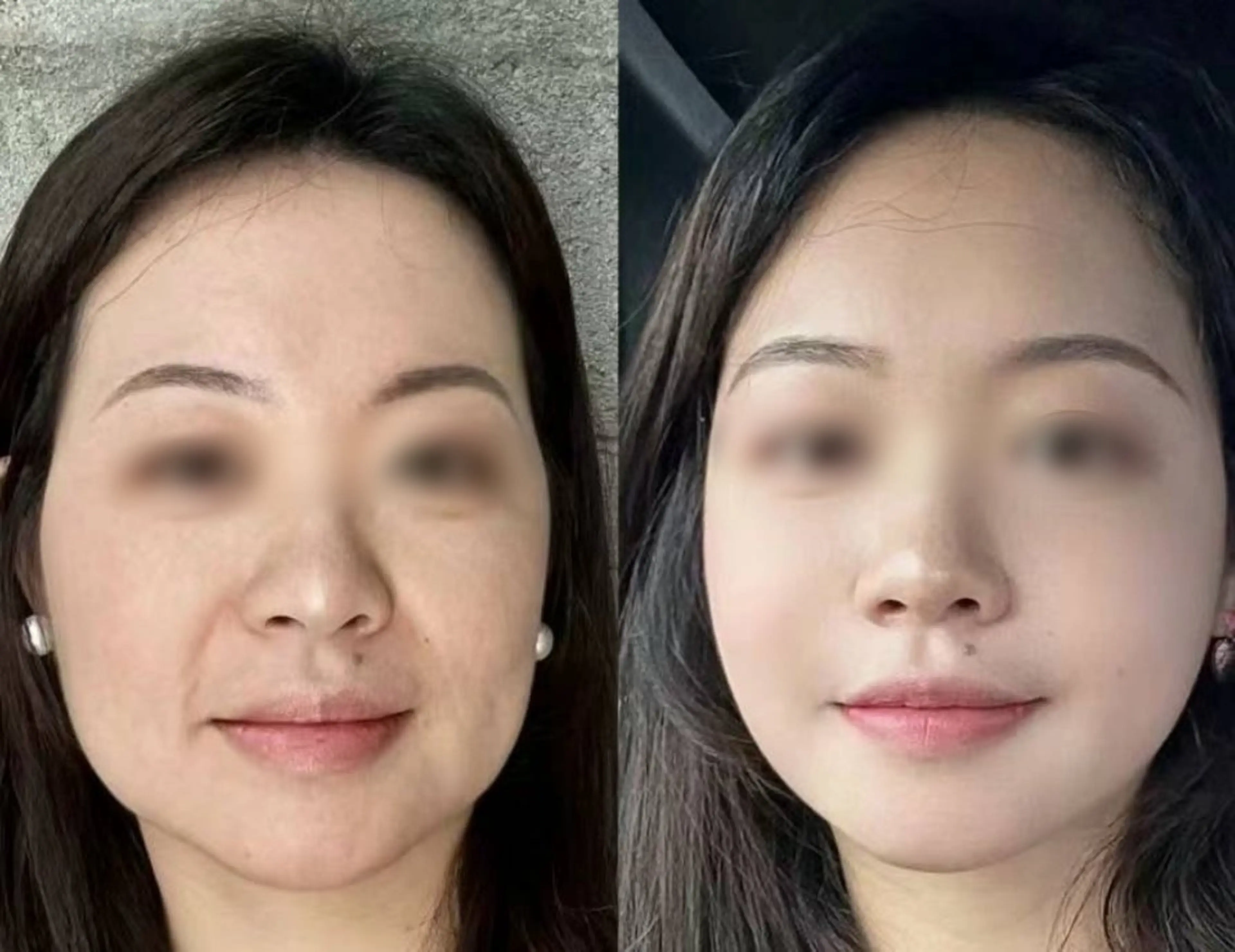 ネイル ブライダルネイル ホワイト aliaハイフ&水光ジェットサロン所属・aliaハーブ水光店 エステティシャン募集のエステ・リラクイメージ