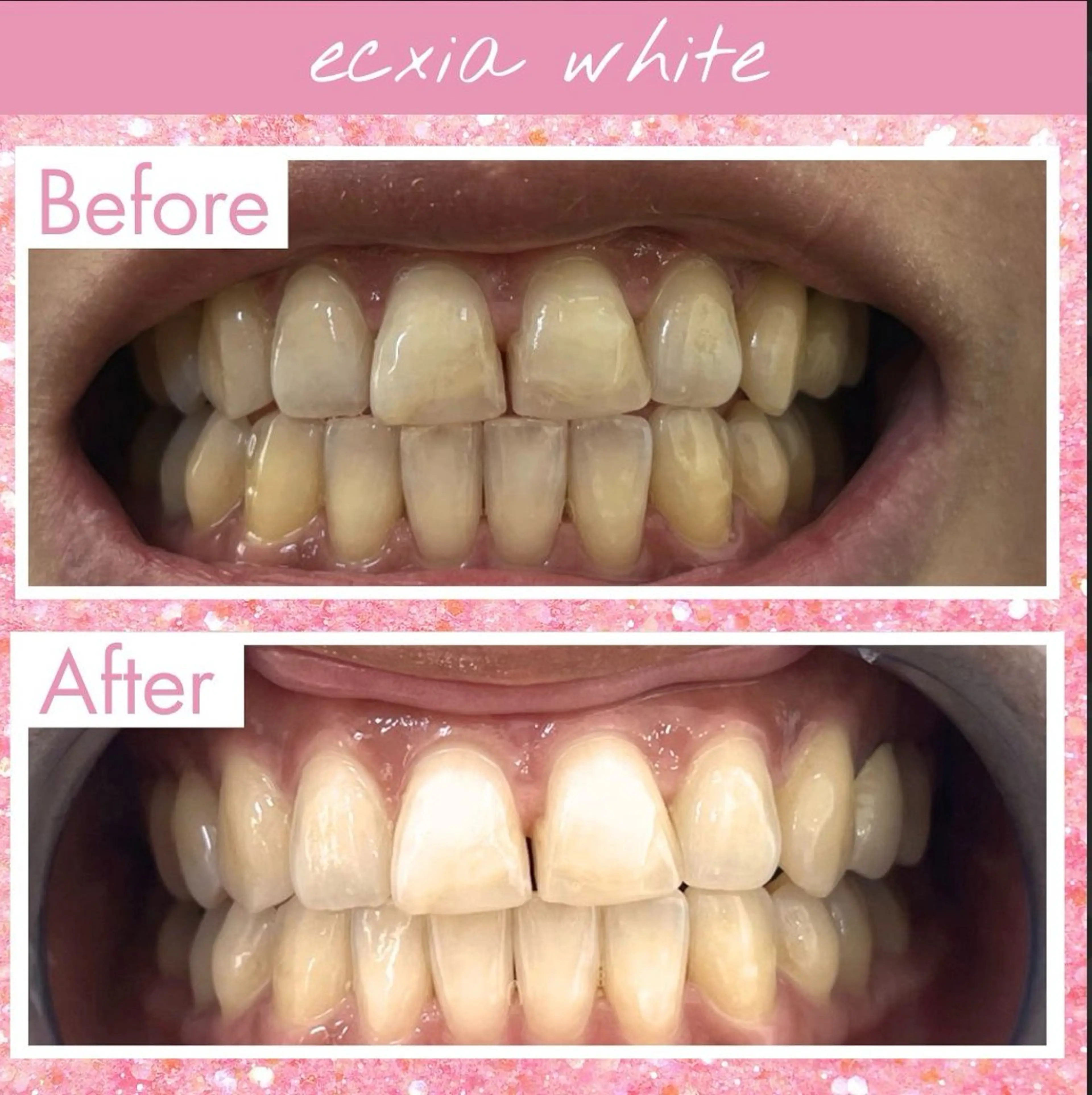 その他 エクシアホワイト 💟fukaのその他イメージ