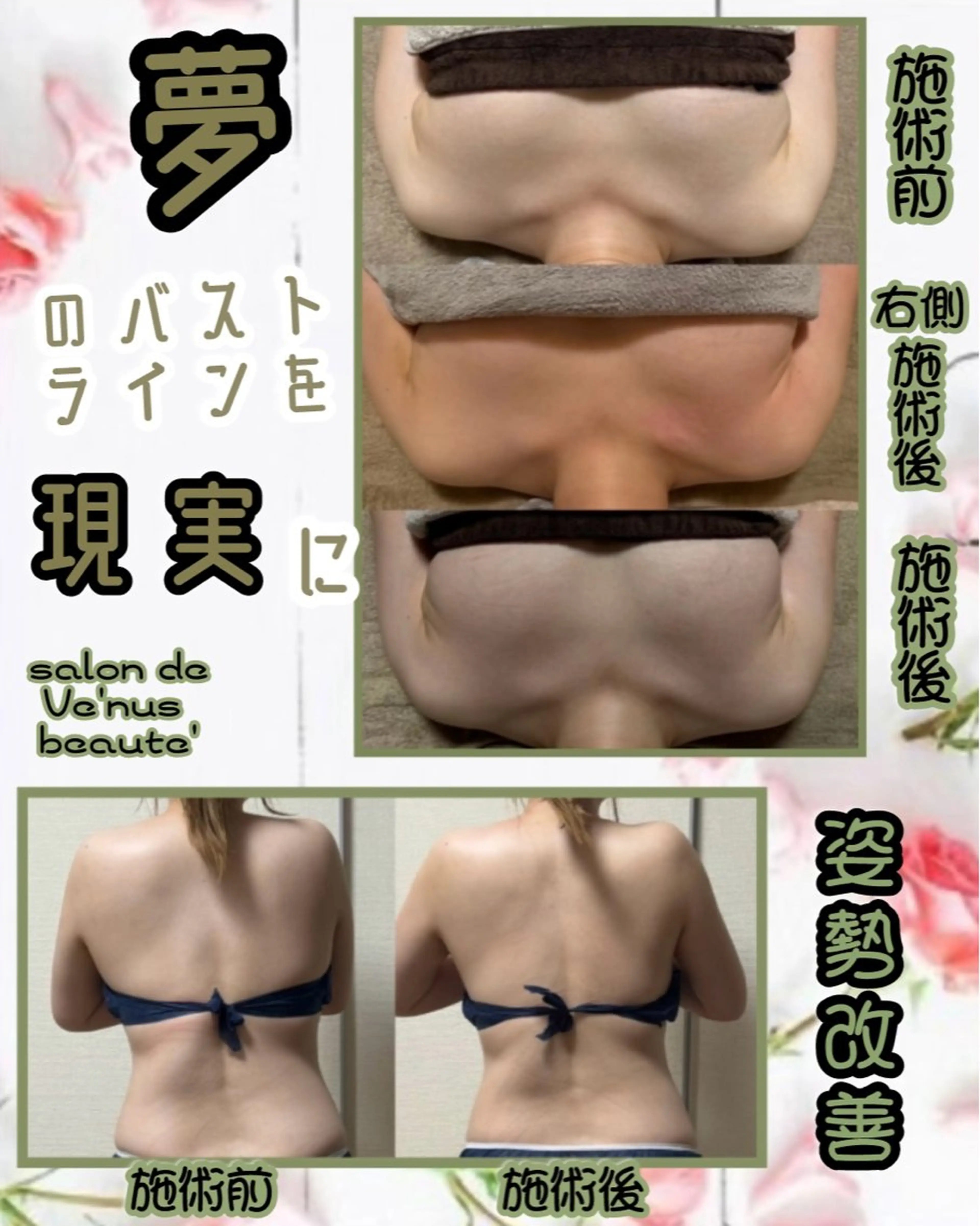 エステ ヴィーナス ビューティーのエステ・リラクイメージ