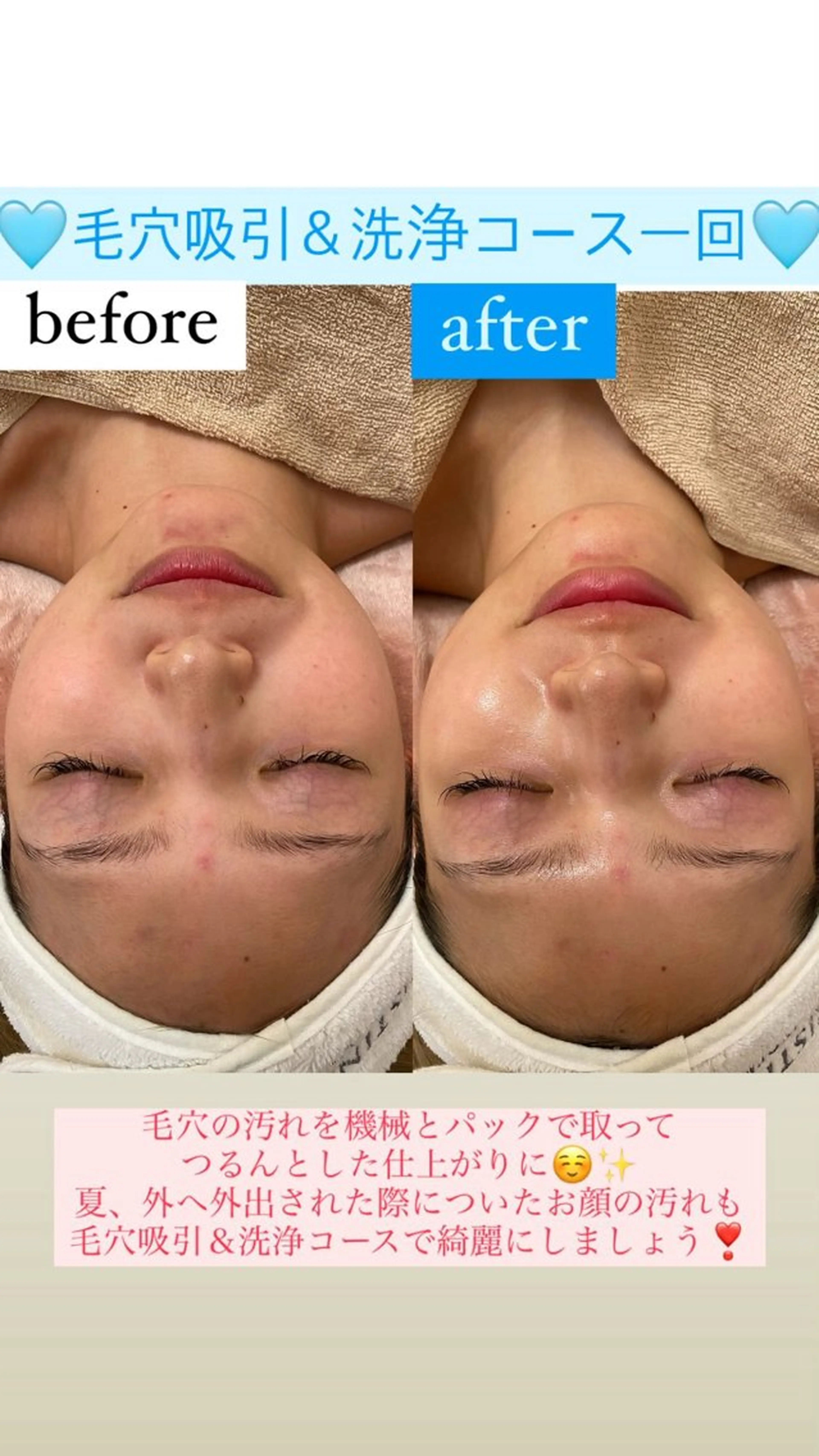 メンズ エステ Salon de Lino 御器所のエステ・リラクイメージ