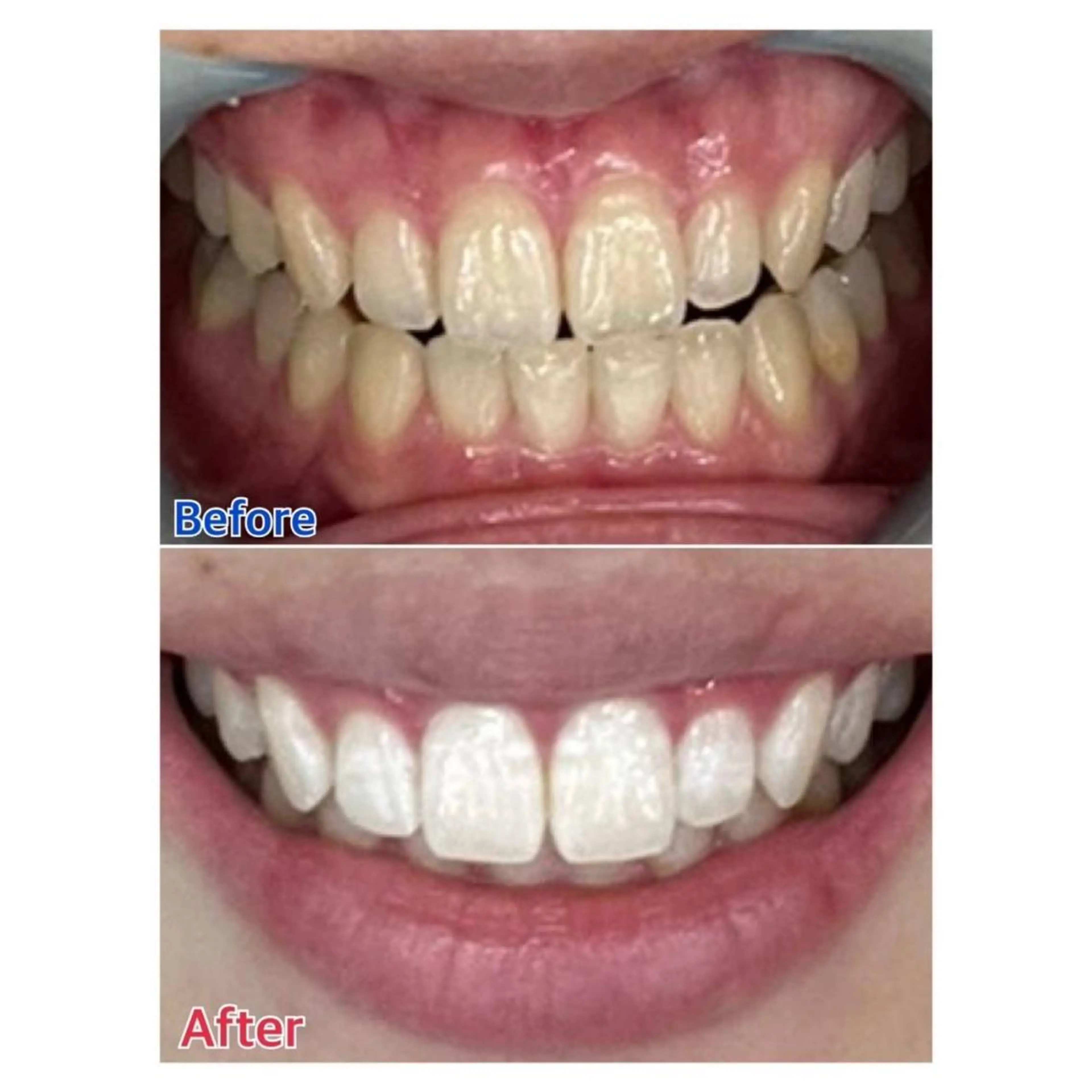 MBEAUTYSALON 千葉店・京成大久保所属・Melty 輝のその他イメージ