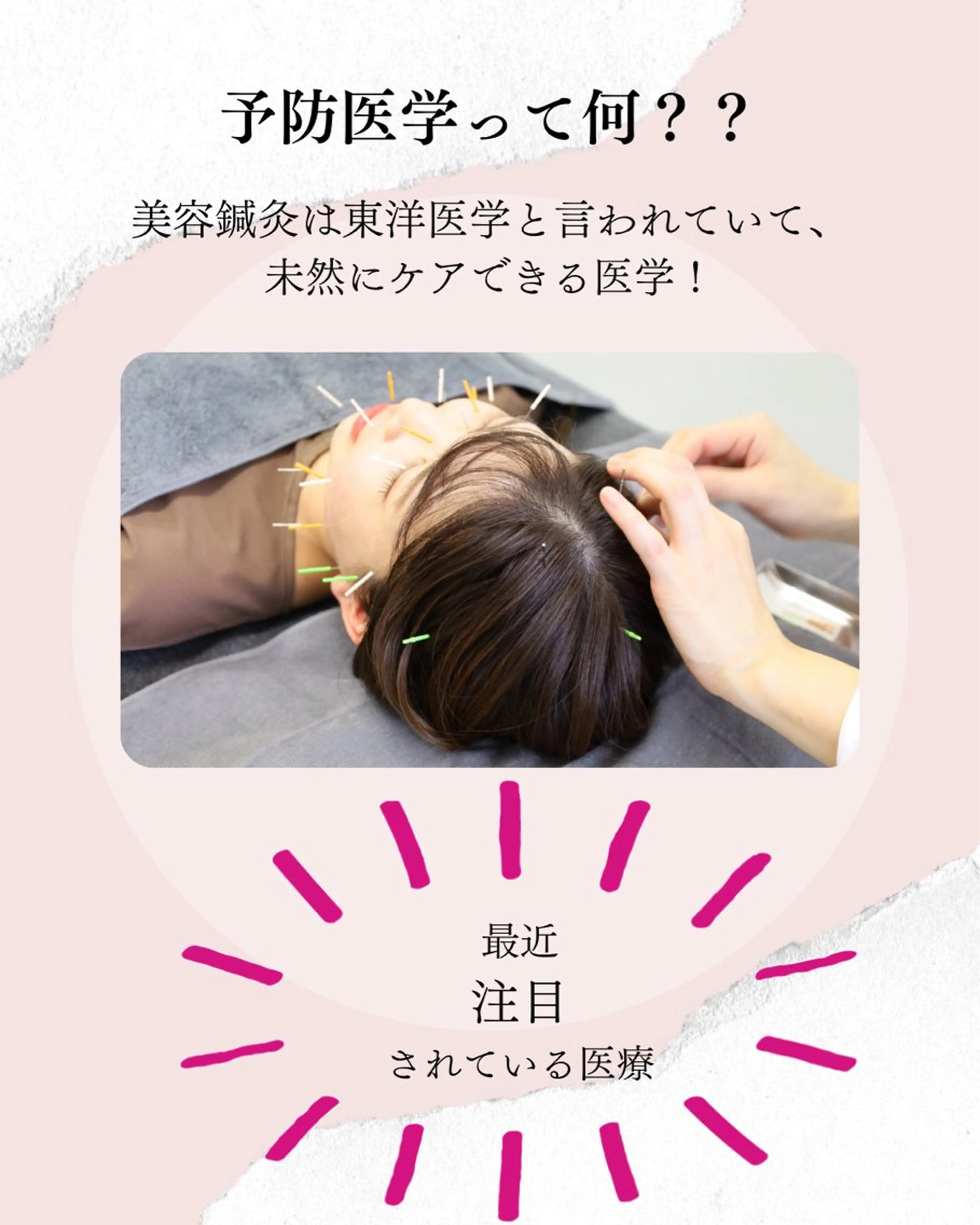 エステ ニキビ特化美容鍼 ×ハーブピーリングのエステ・リラクイメージ