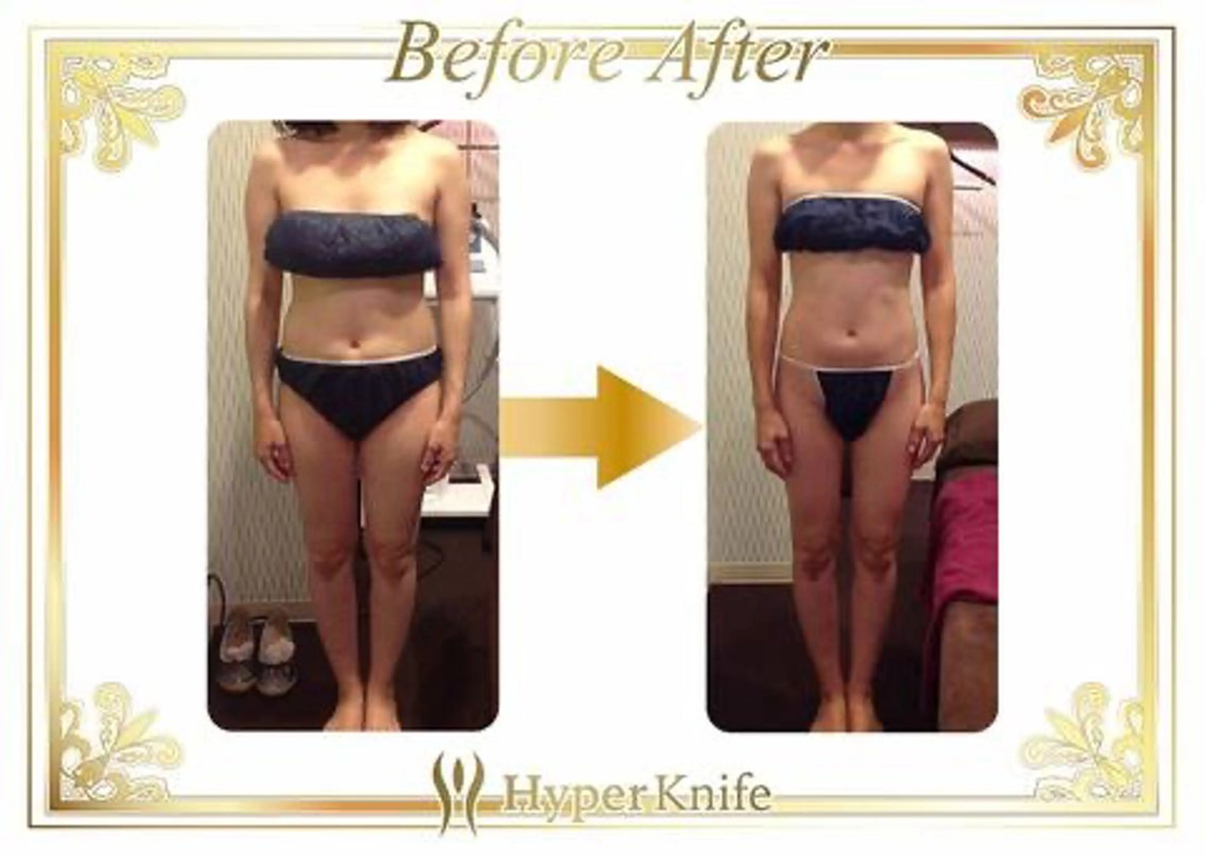 痩身&小顔サロン L i l yA sのエステ・リラクイメージ