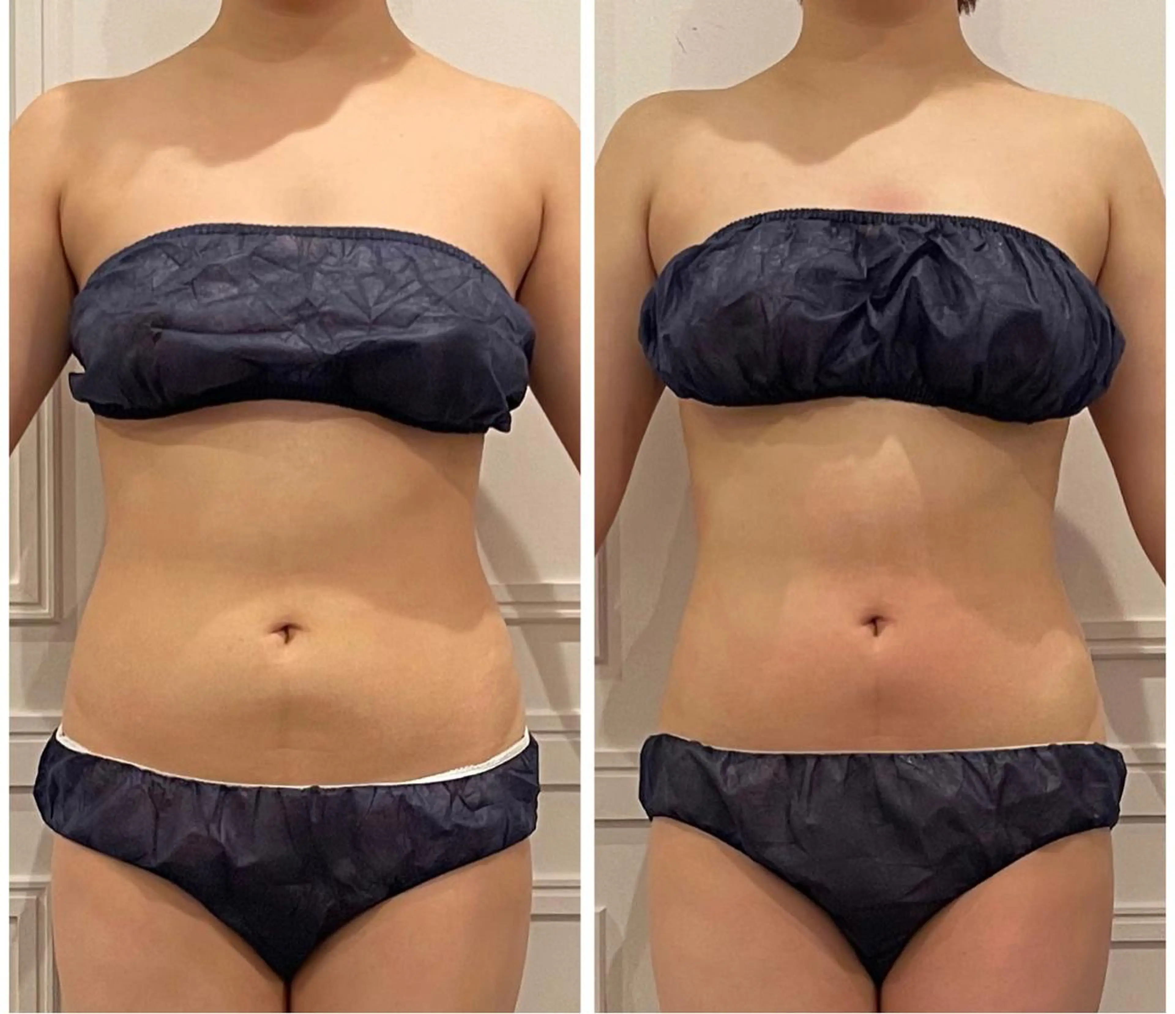 【レディース】ハイパーナイフで美くびれor美脚作り🔥ほぐし×燃やす×排泄💦代謝が気になる方にもオススメ💛の写真