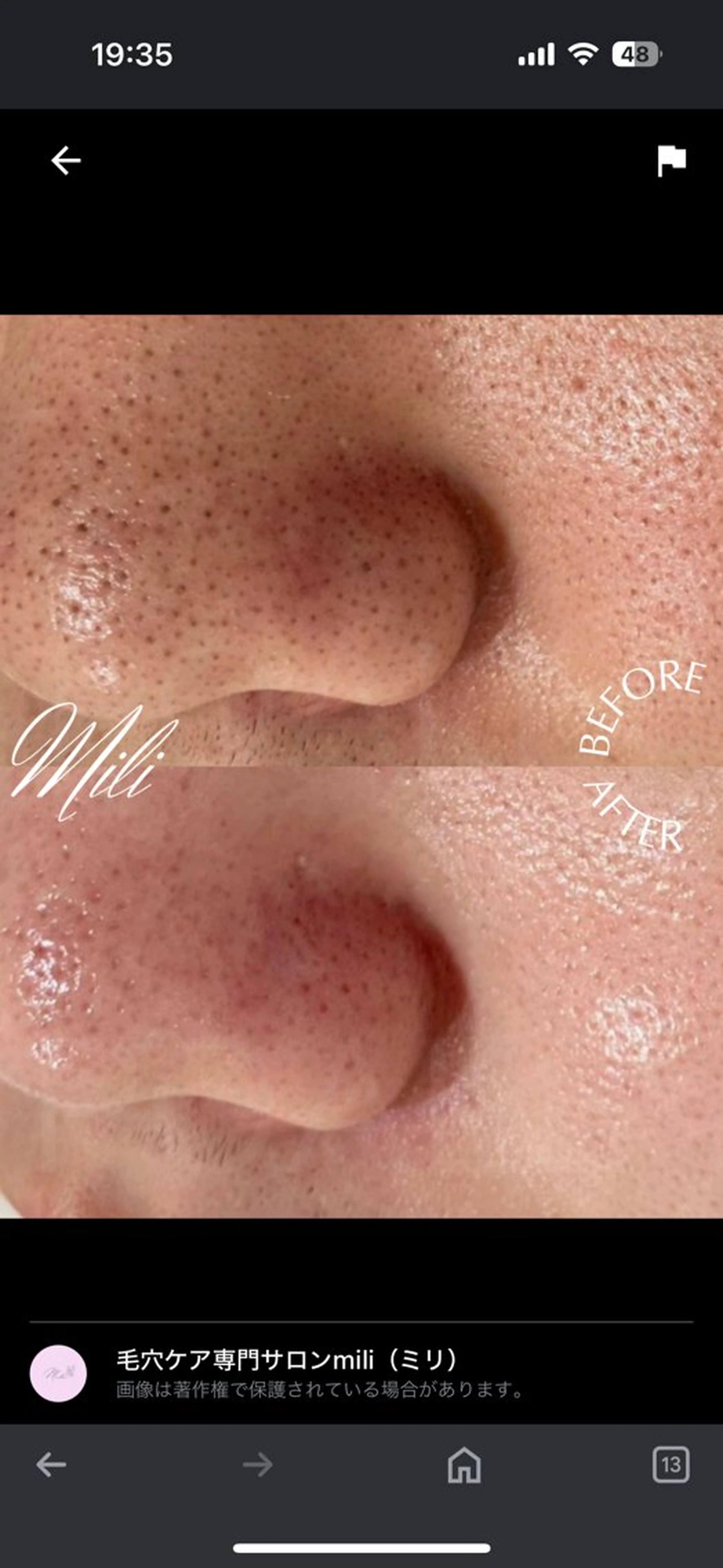 毛穴専門店 mili柏のエステ・リラクイメージ