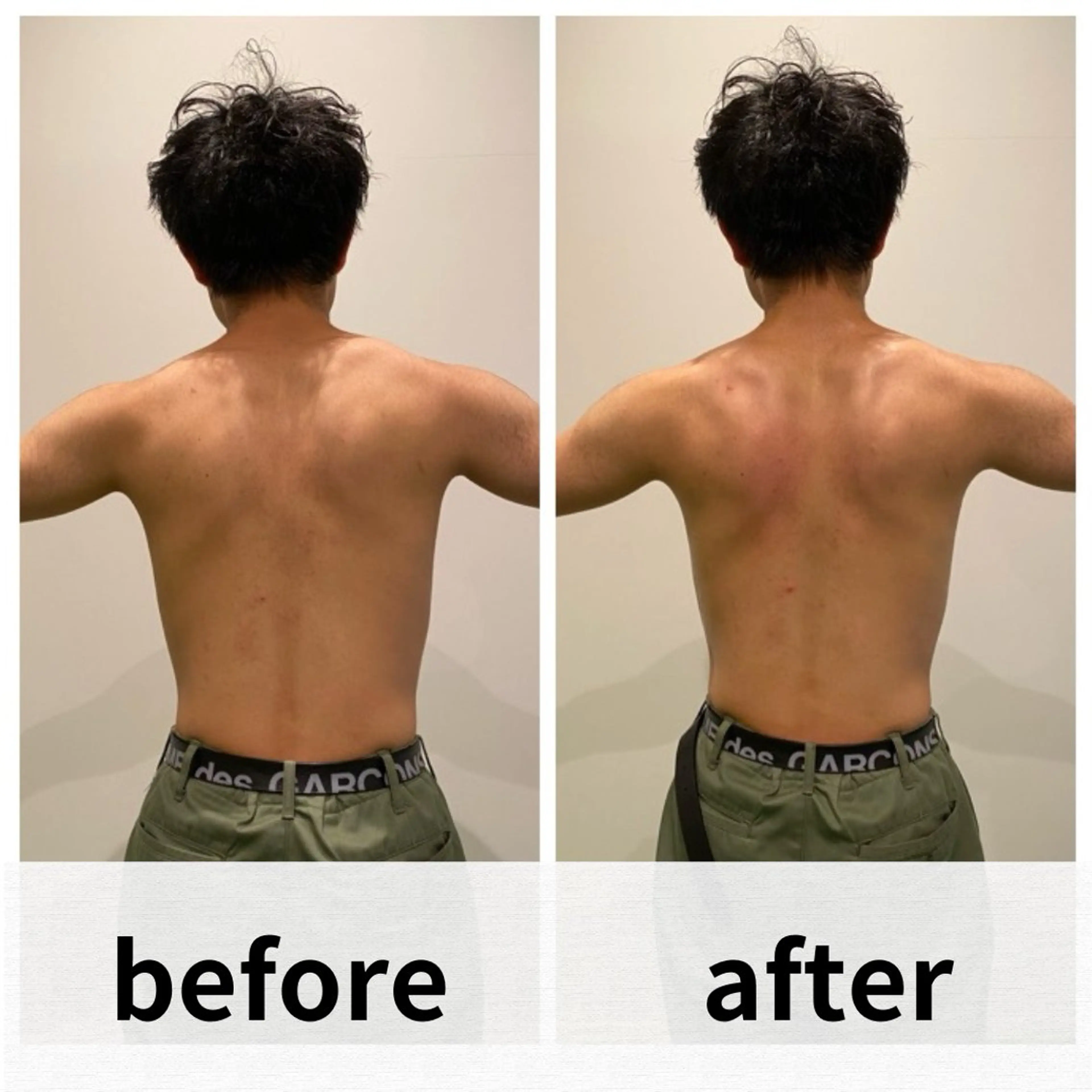 美容鍼/ヘッドスパ/ 💎さかもとのエステ・リラクイメージ