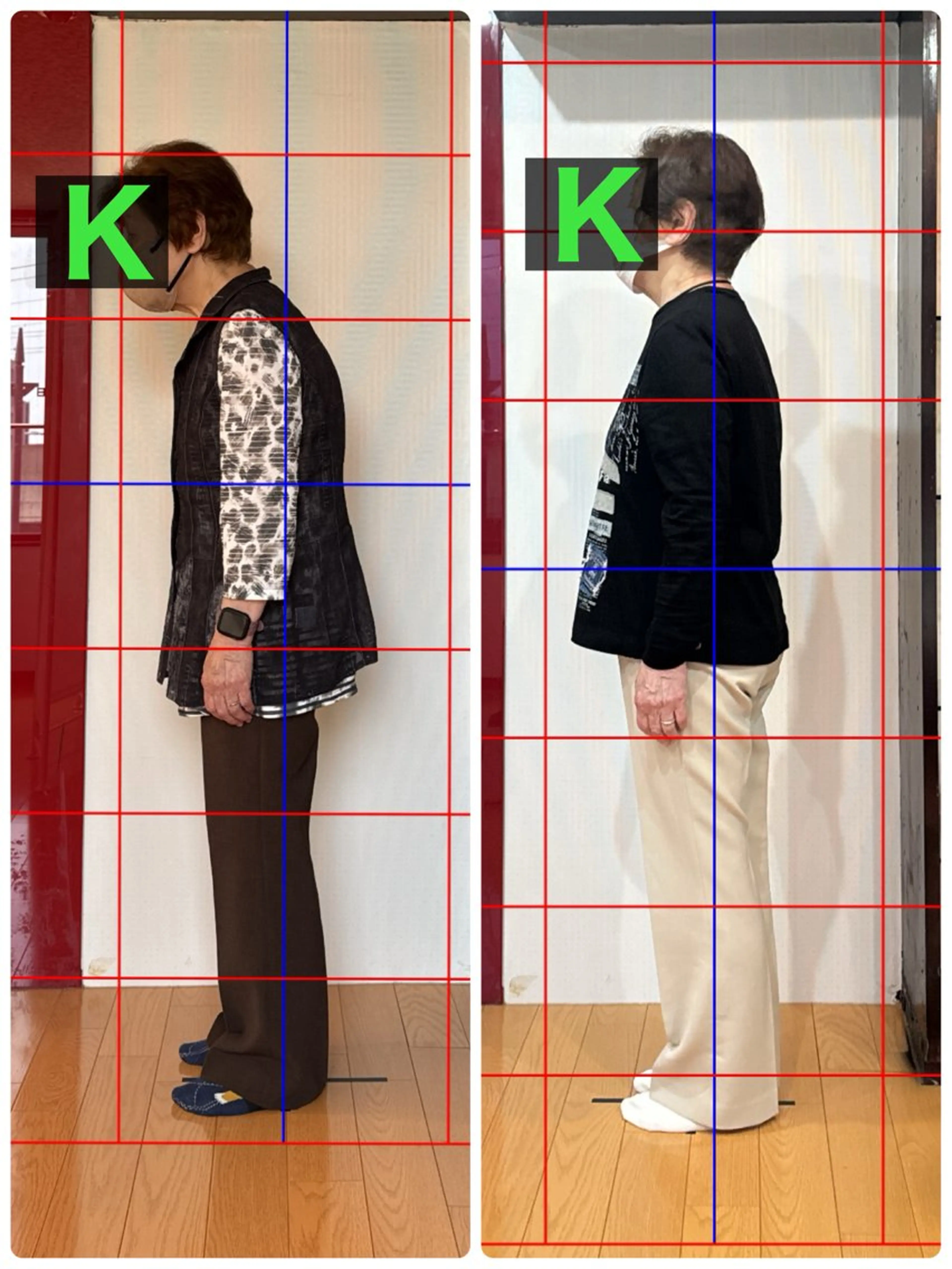 猫背・巻き肩改善整体の写真
