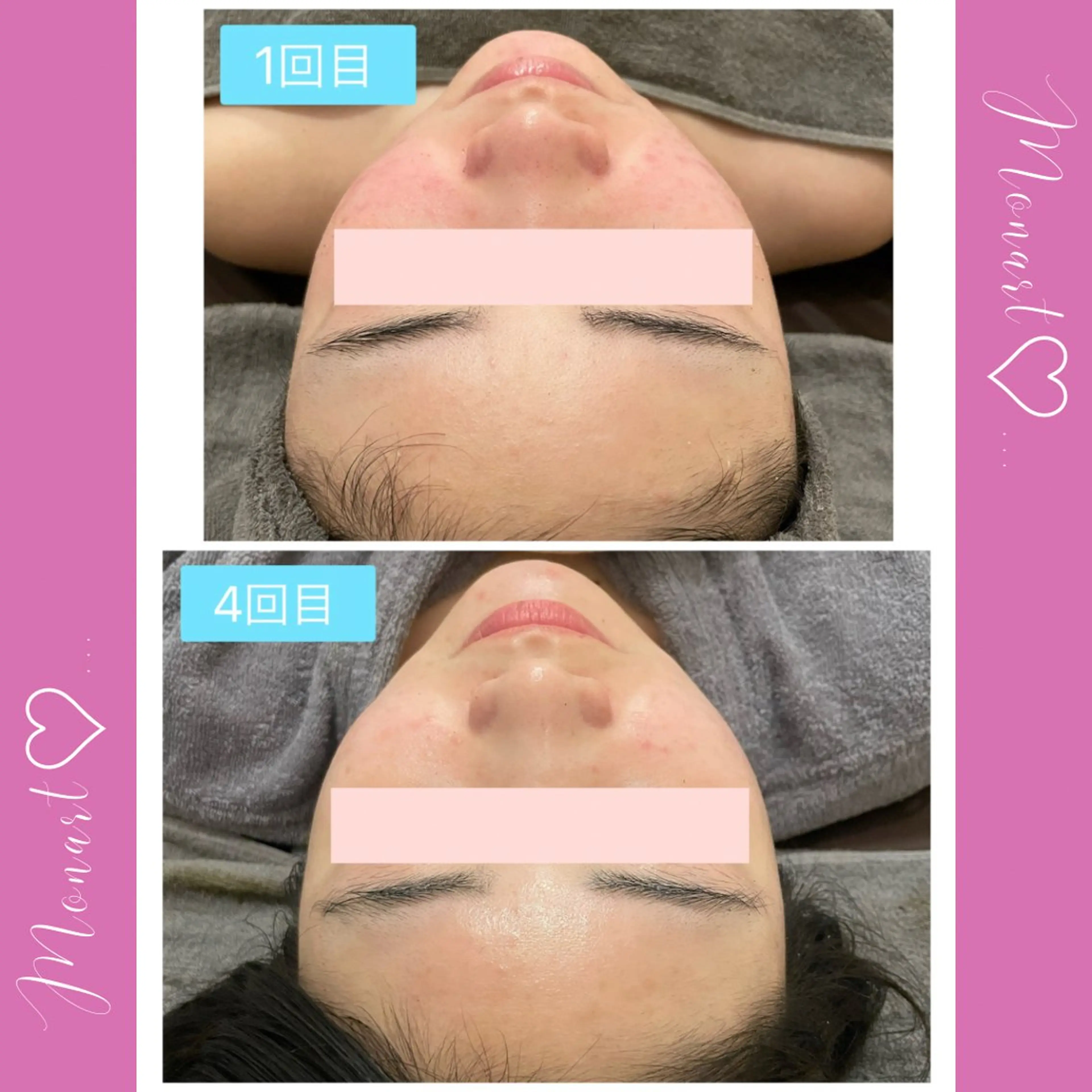 Monart -deux-のエステ・リラクイメージ