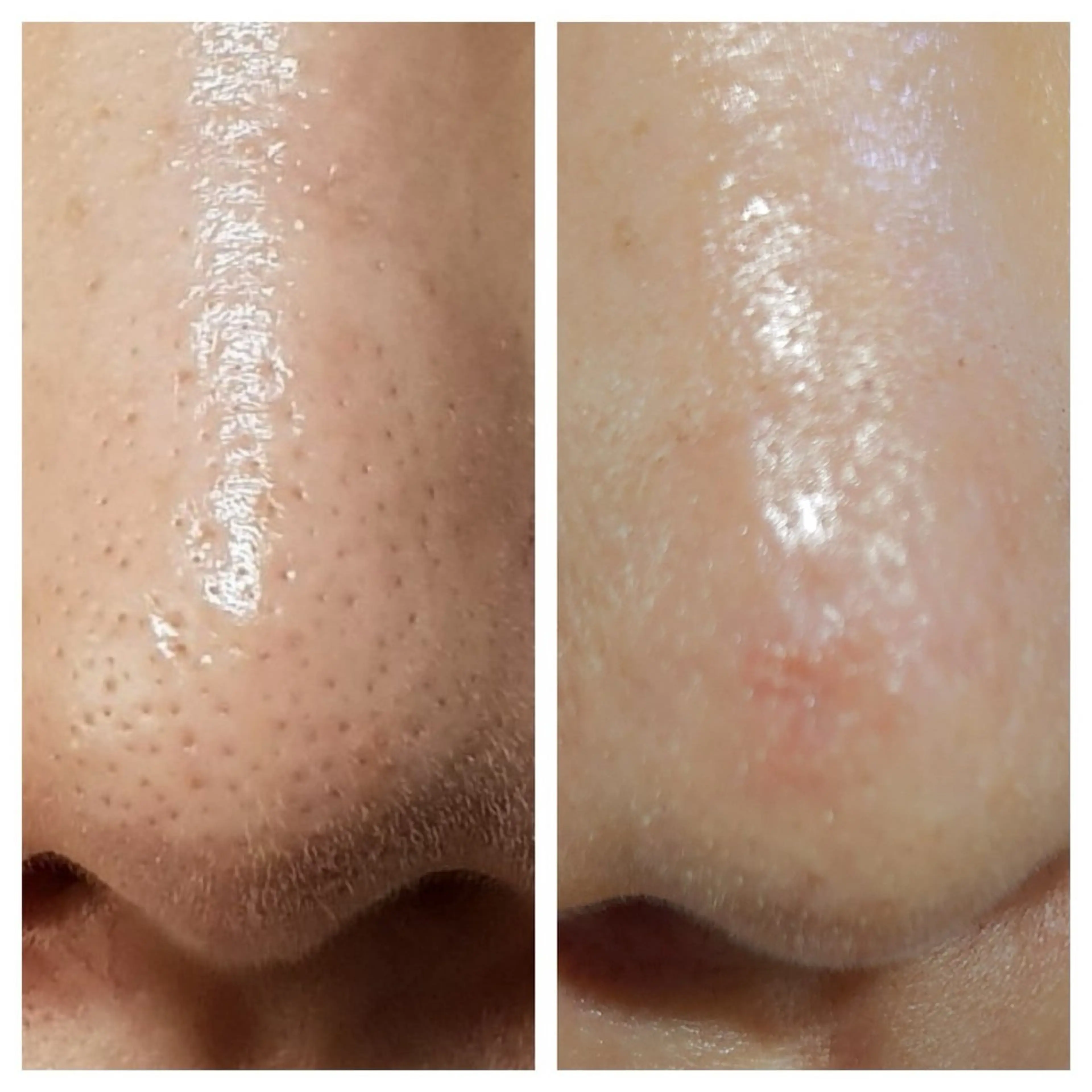 エステ 看護師が施術する ナスサロ/Emi🪽のエステ・リラクイメージ