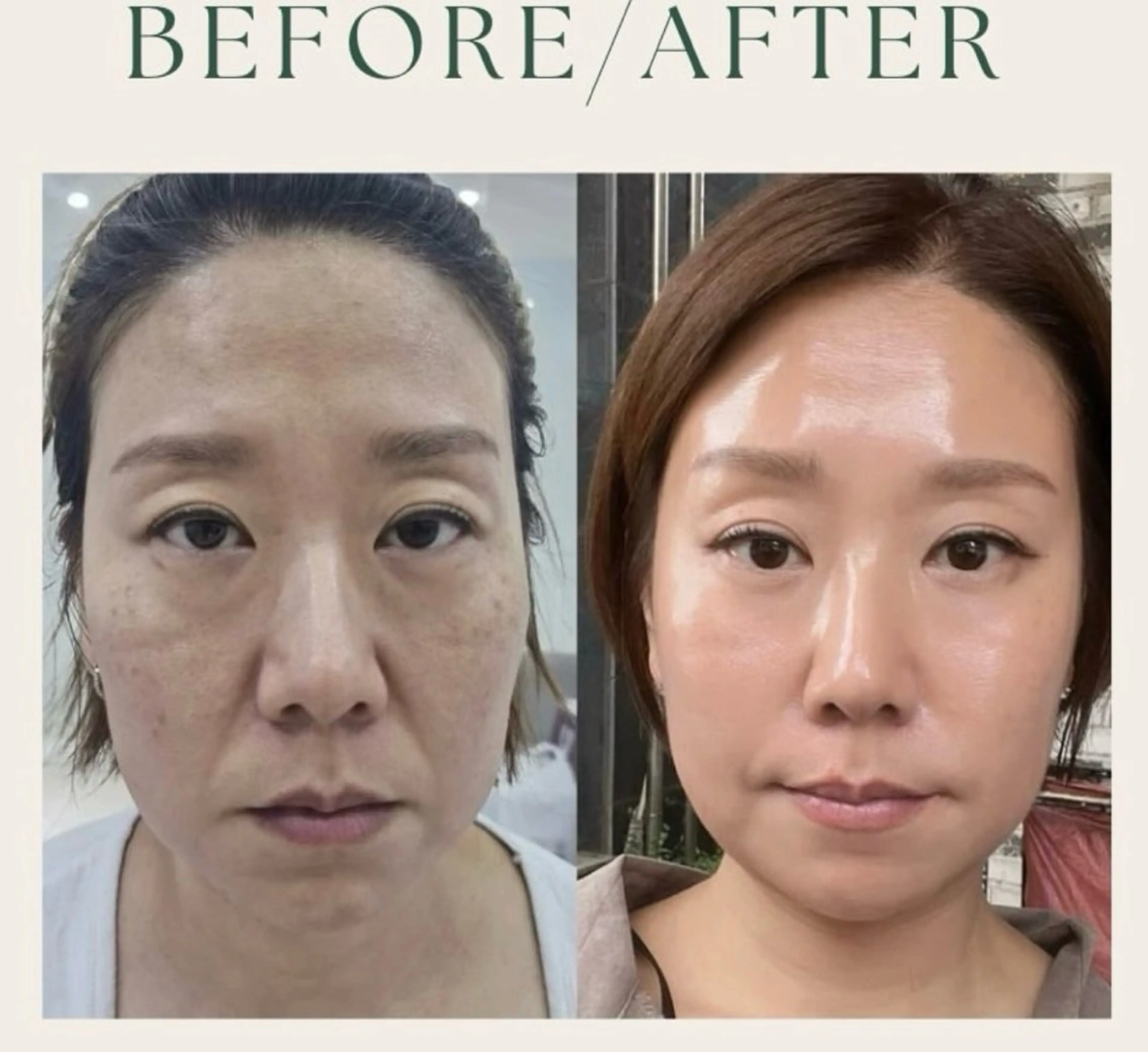 エステ 小顔/たるみ/黒ずみ除去専門サロン/SONA 大和西大寺店所属・【小顔専門看護師 サロンSONA】のエステ・リラクイメージ