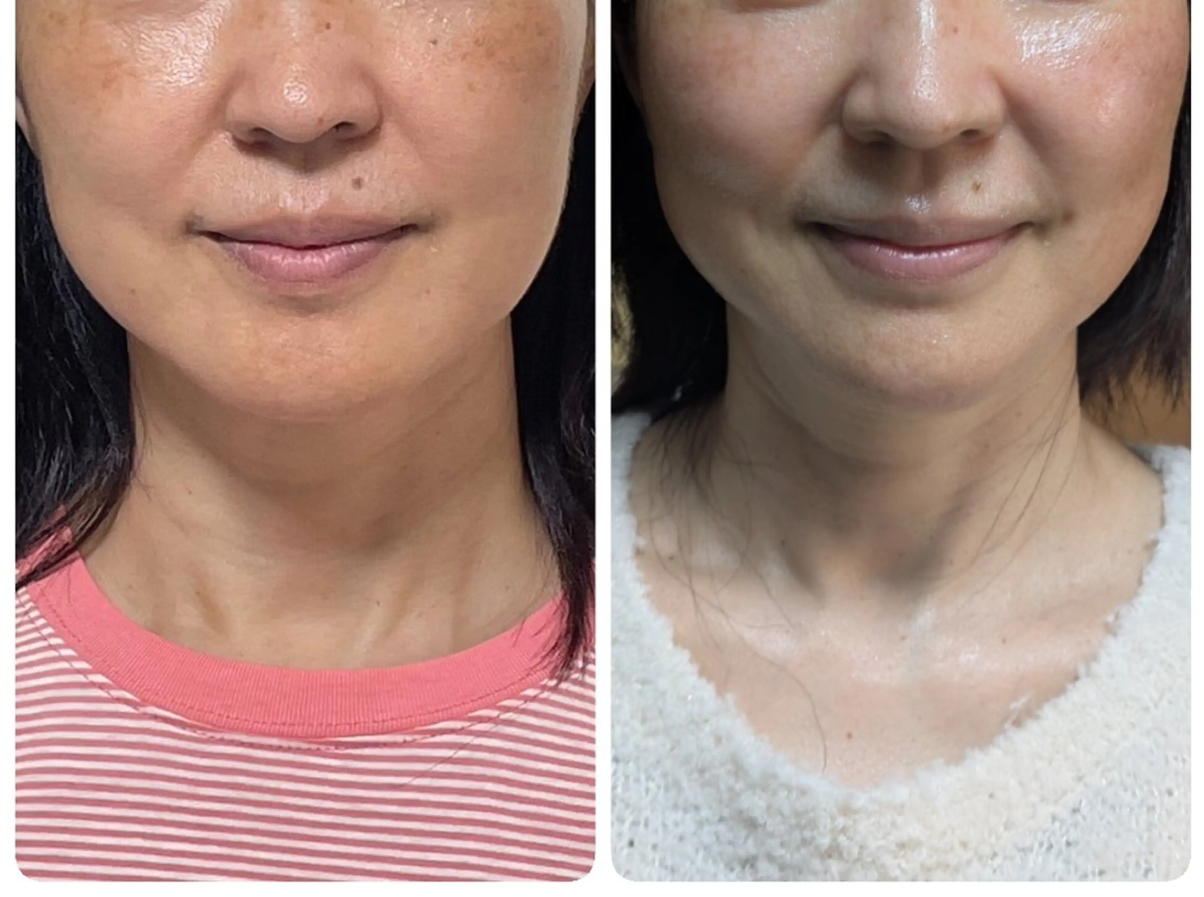 フェイシャルエステ アンソン・ドゥのエステ・リラクイメージ