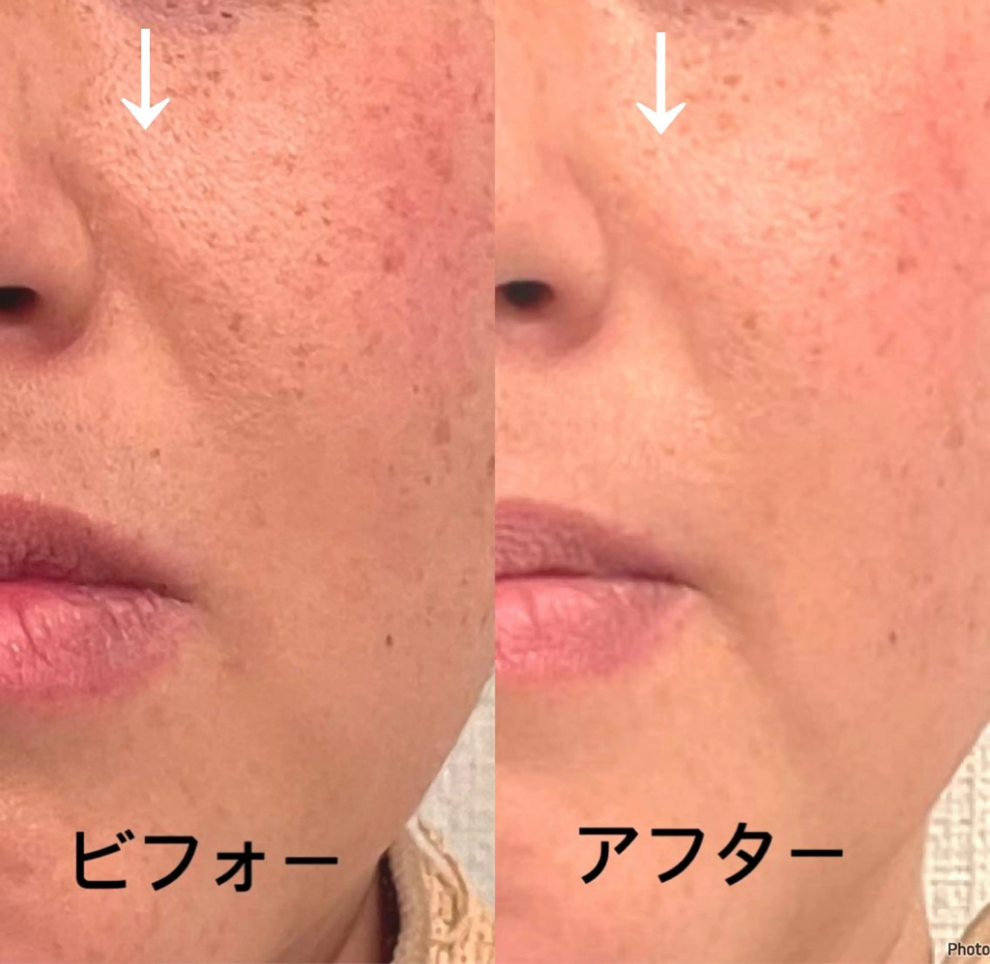 エステ リラク おうちサロン B-ROOMのエステ・リラクイメージ