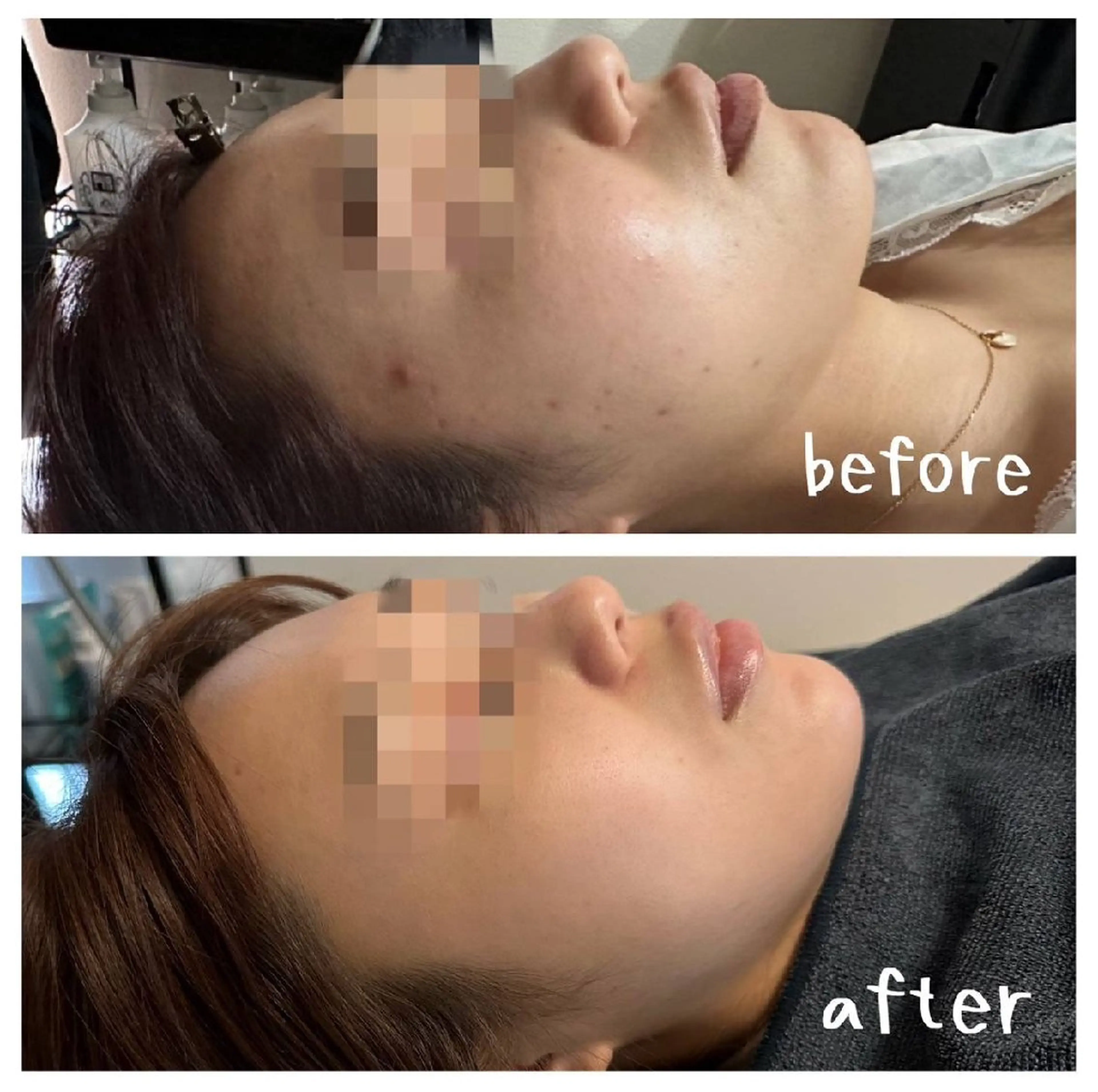 医療提携サロン新宿 La Lunaのエステ・リラクイメージ