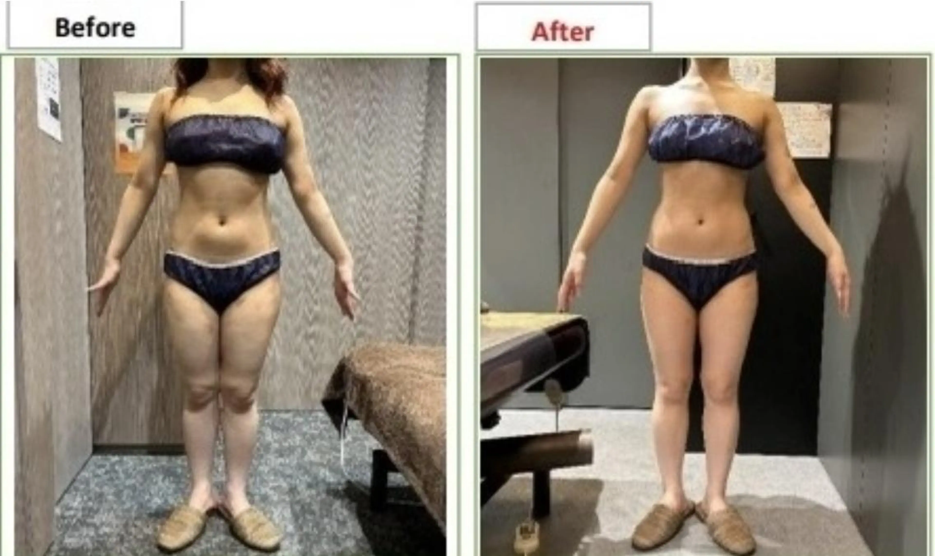 🎀Linora byRAYVS🎀のエステ・リラクイメージ