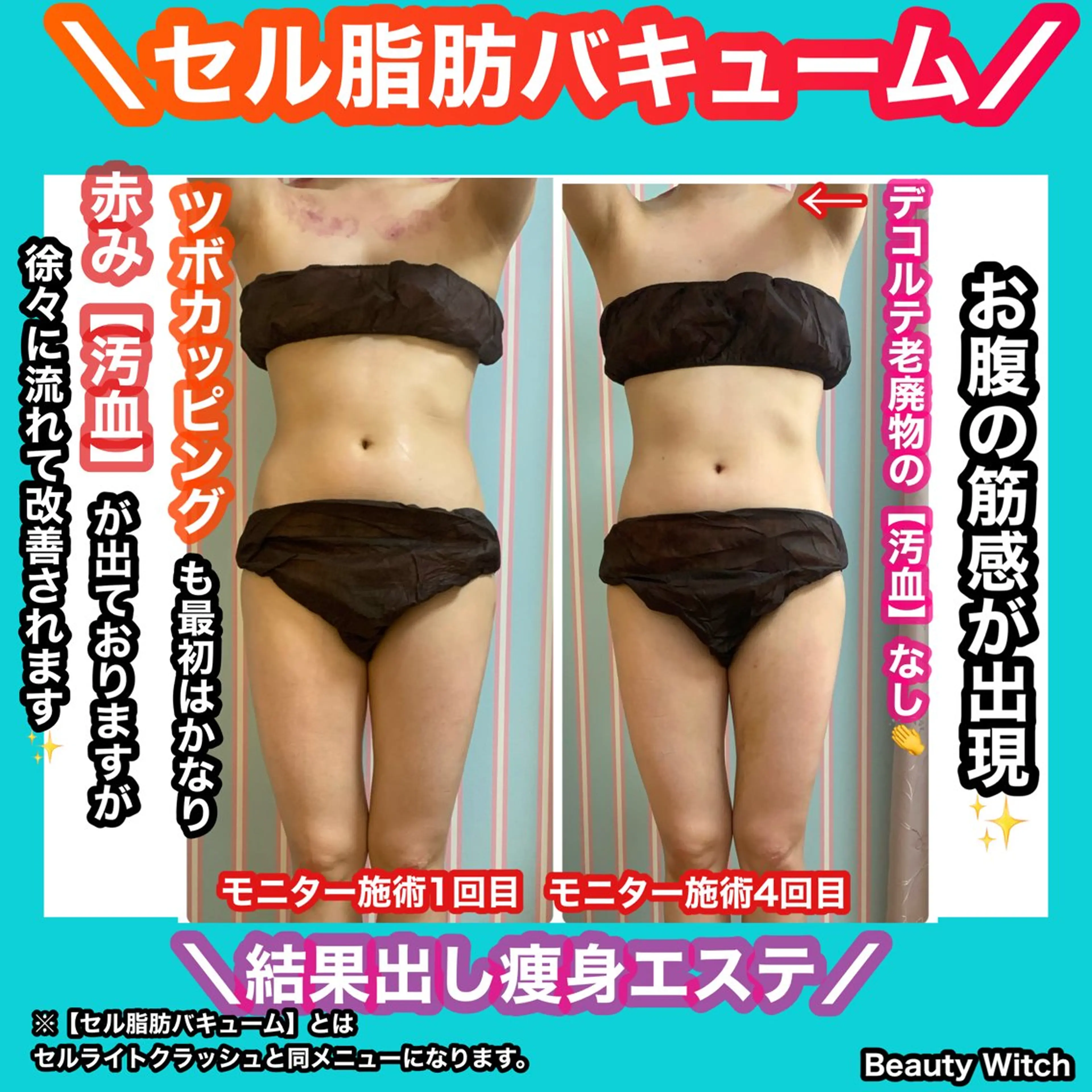 痩身/脱毛/ネイル HARUKAのエステ・リラクイメージ