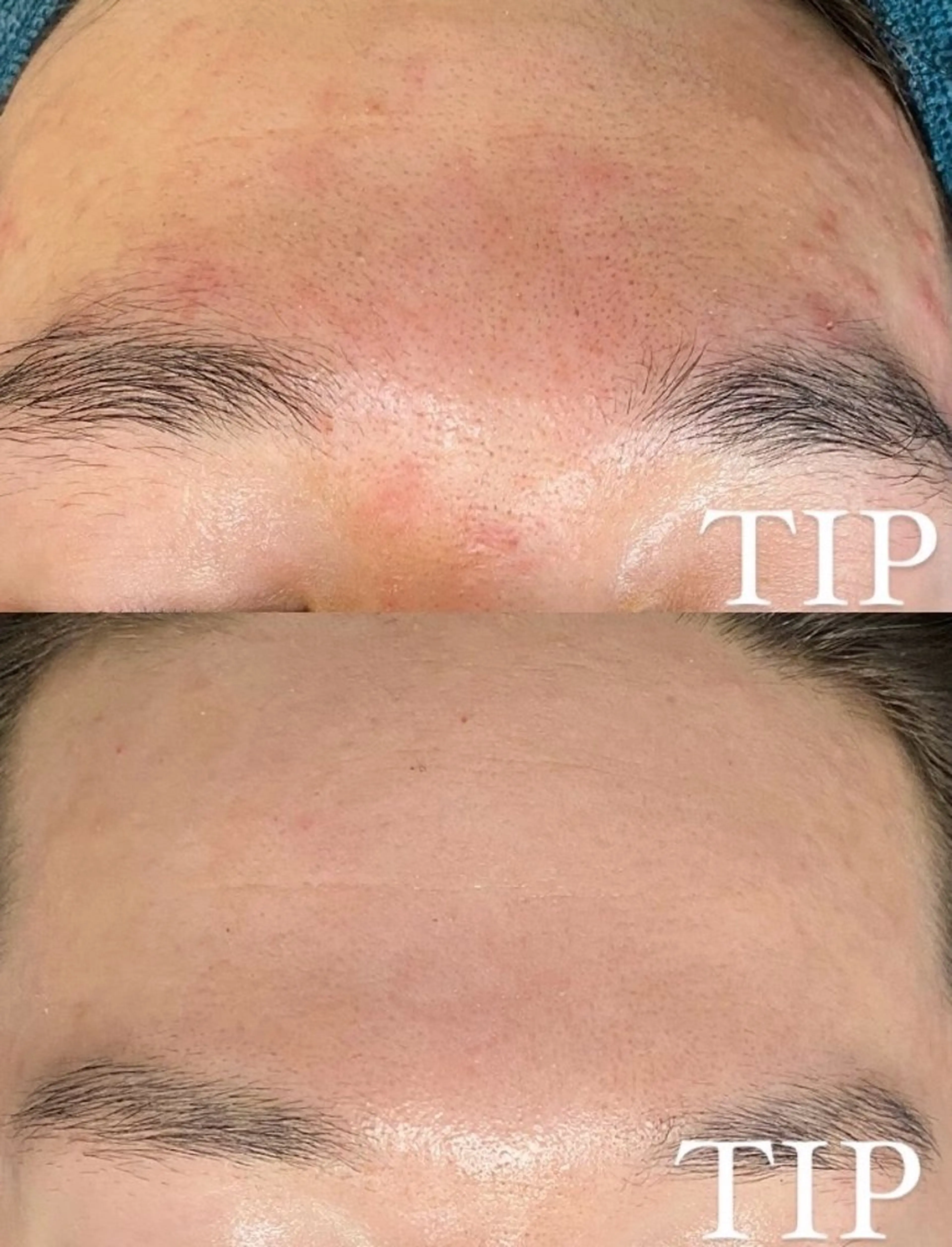 パーソナル肌質改善 🦋APRI🅿️有のエステ・リラクイメージ