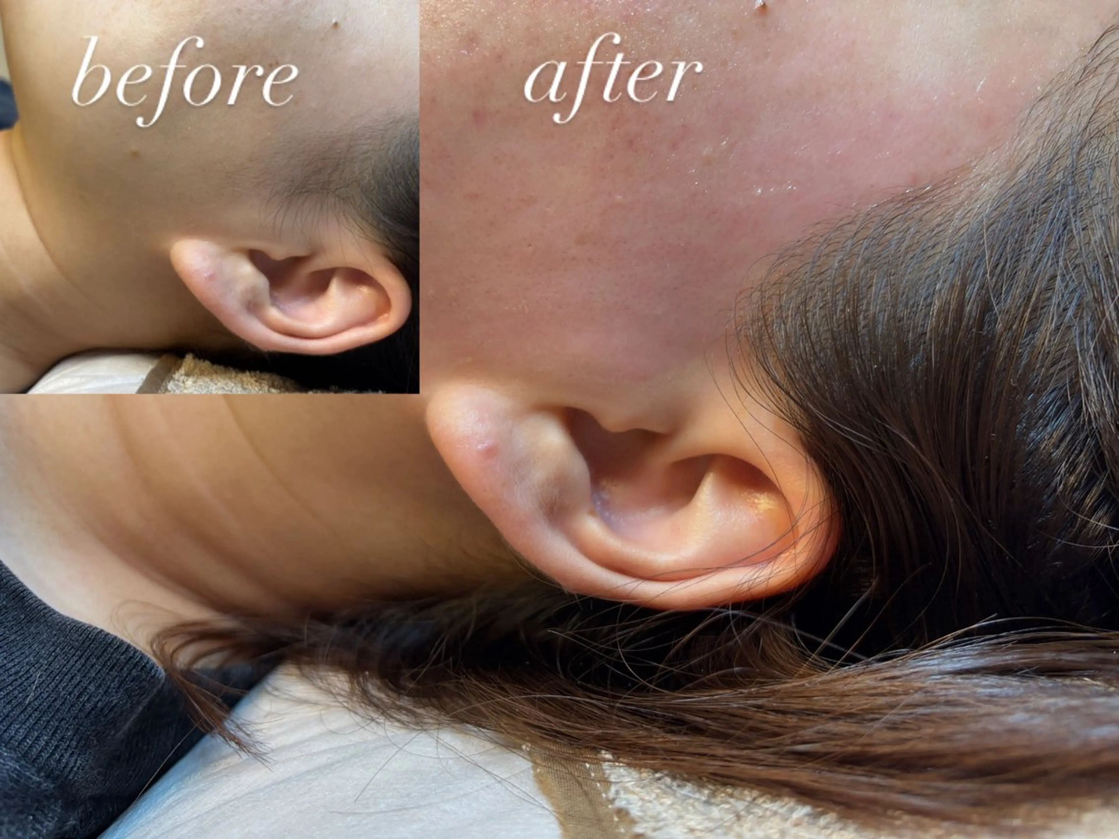 sourire.11 ‪☺︎‬‪emiのエステ・リラクイメージ