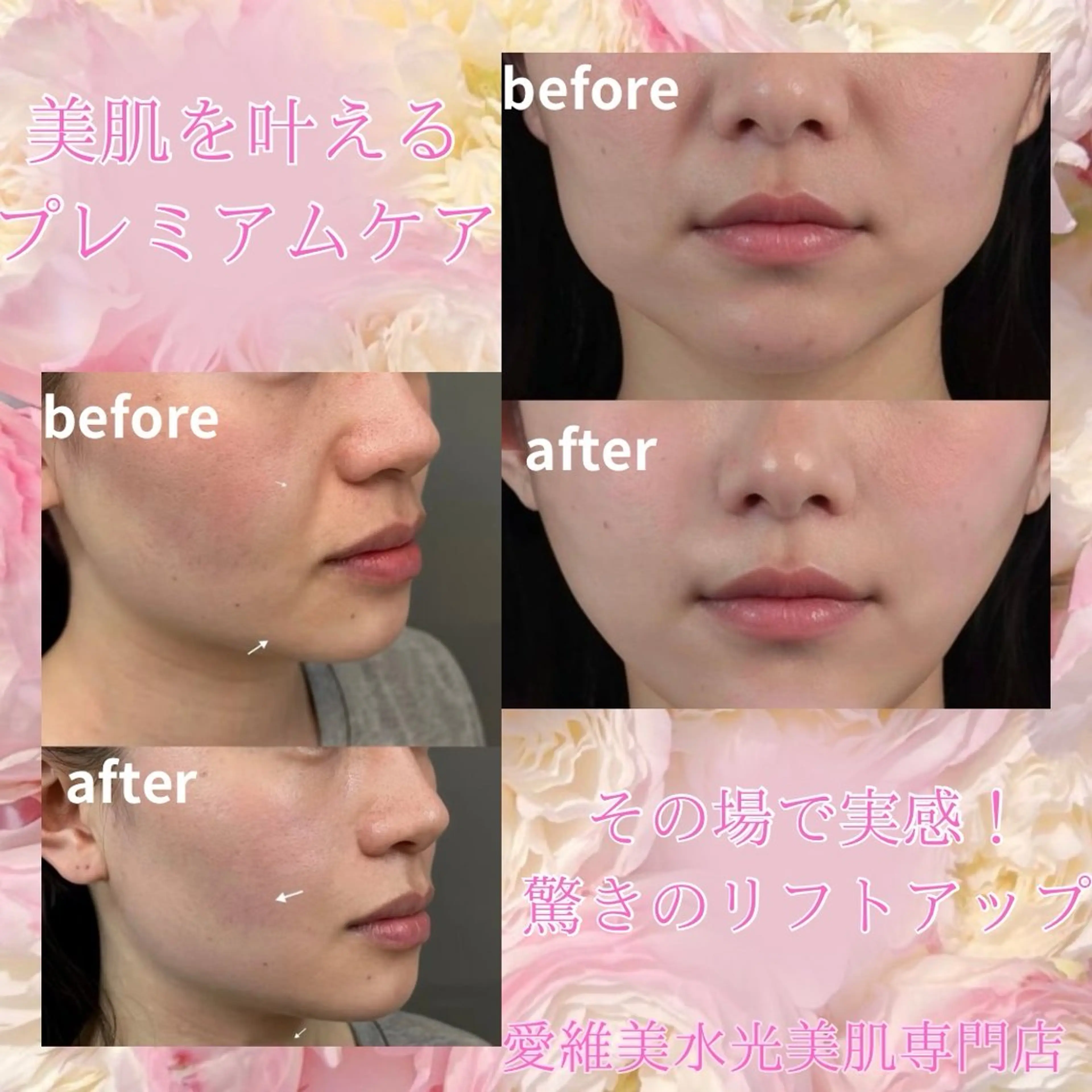 マツエク・マツパ エステ aliaハイフ&水光ジェットサロン所属・aliaハーブ水光店 エステティシャン募集のエステ・リラクイメージ