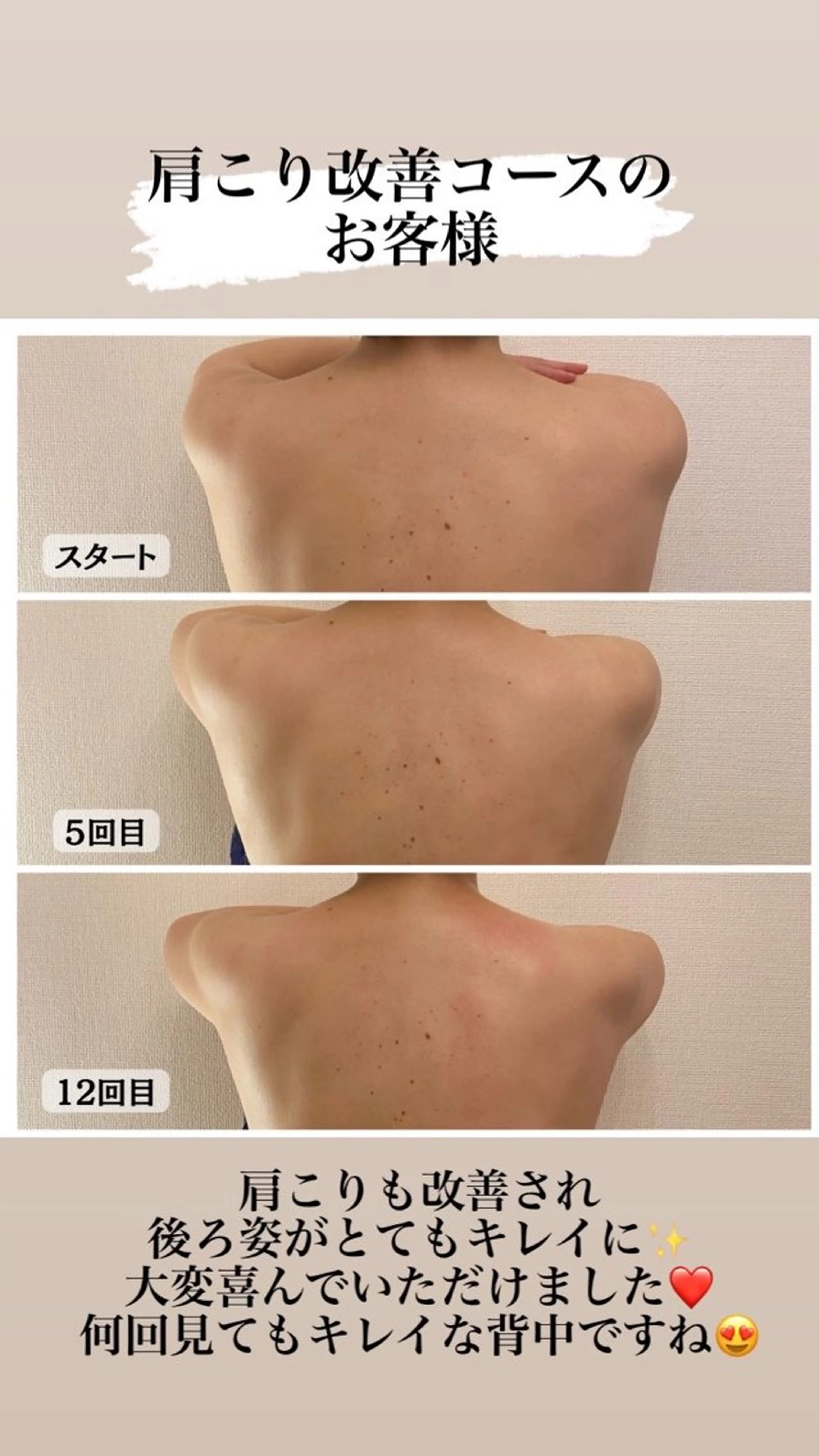 辛い肩こりバイバイコース　30分の写真