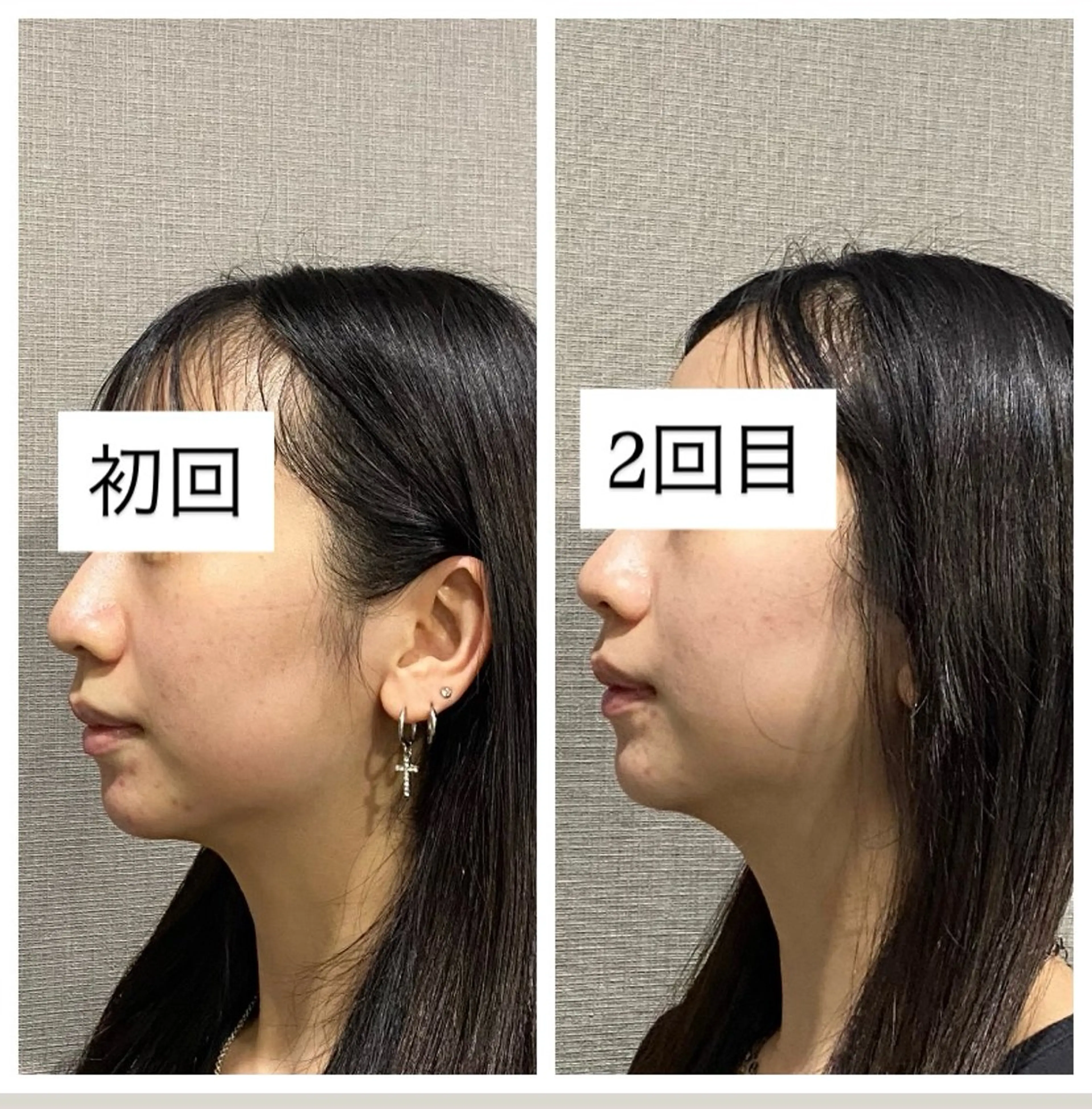 エステ 肌質改善専門 ハーブ /毛穴洗浄 リエイトのエステ・リラクイメージ