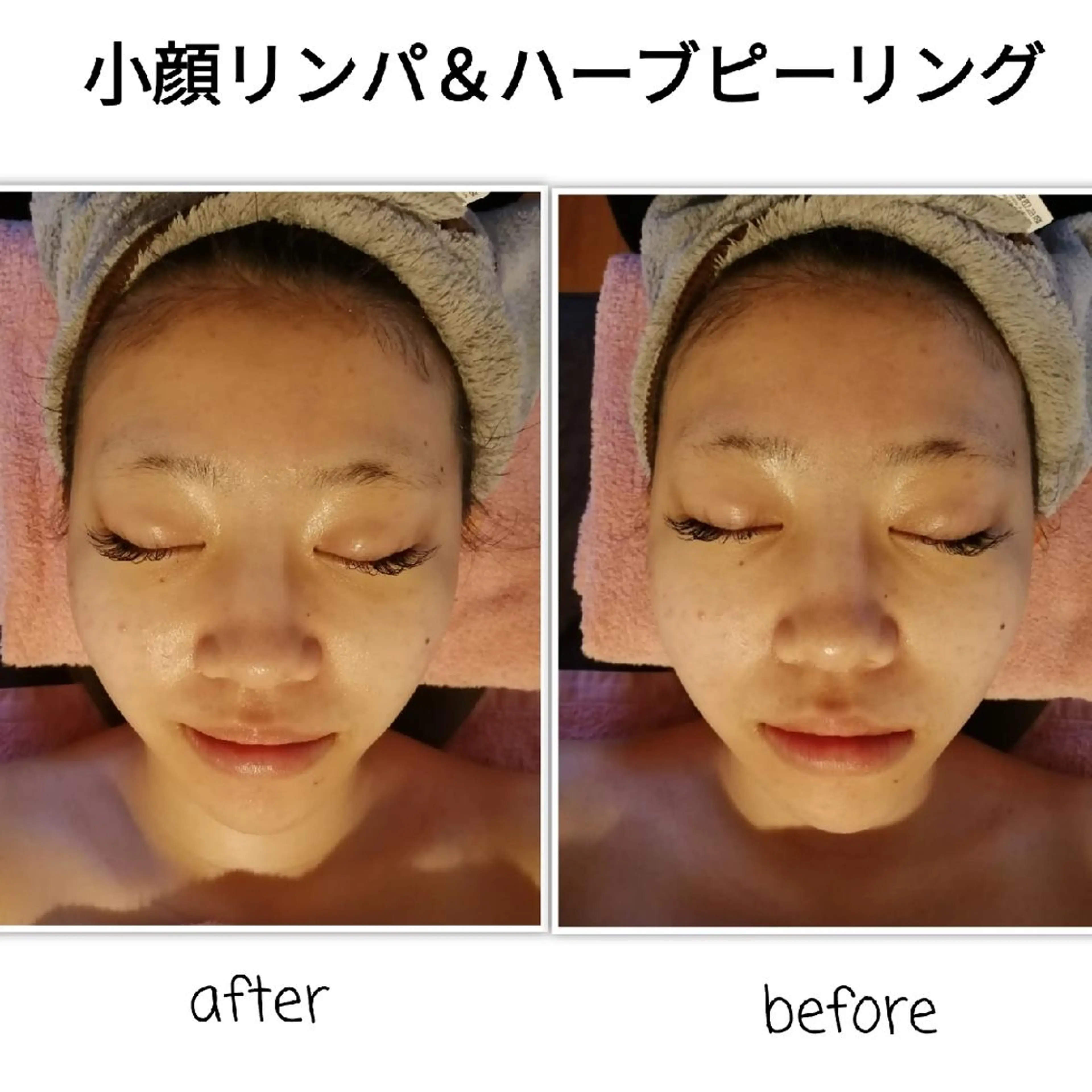 未病ケアサロン　EMINY所属・未病ケアサロン EMINY☺︎勝俣のエステ・リラクイメージ