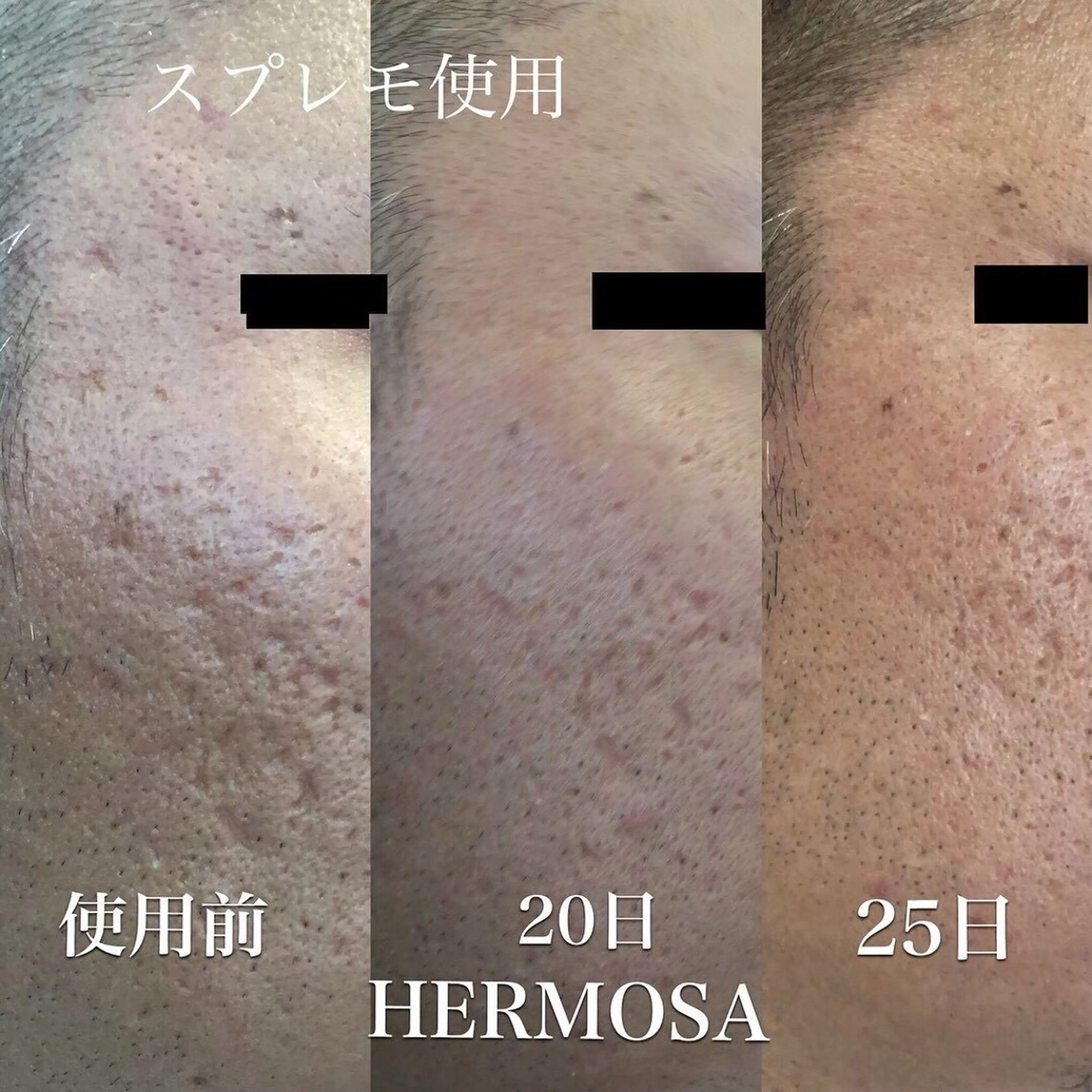 オールハンド フェイシャルのエステ・リラクイメージ