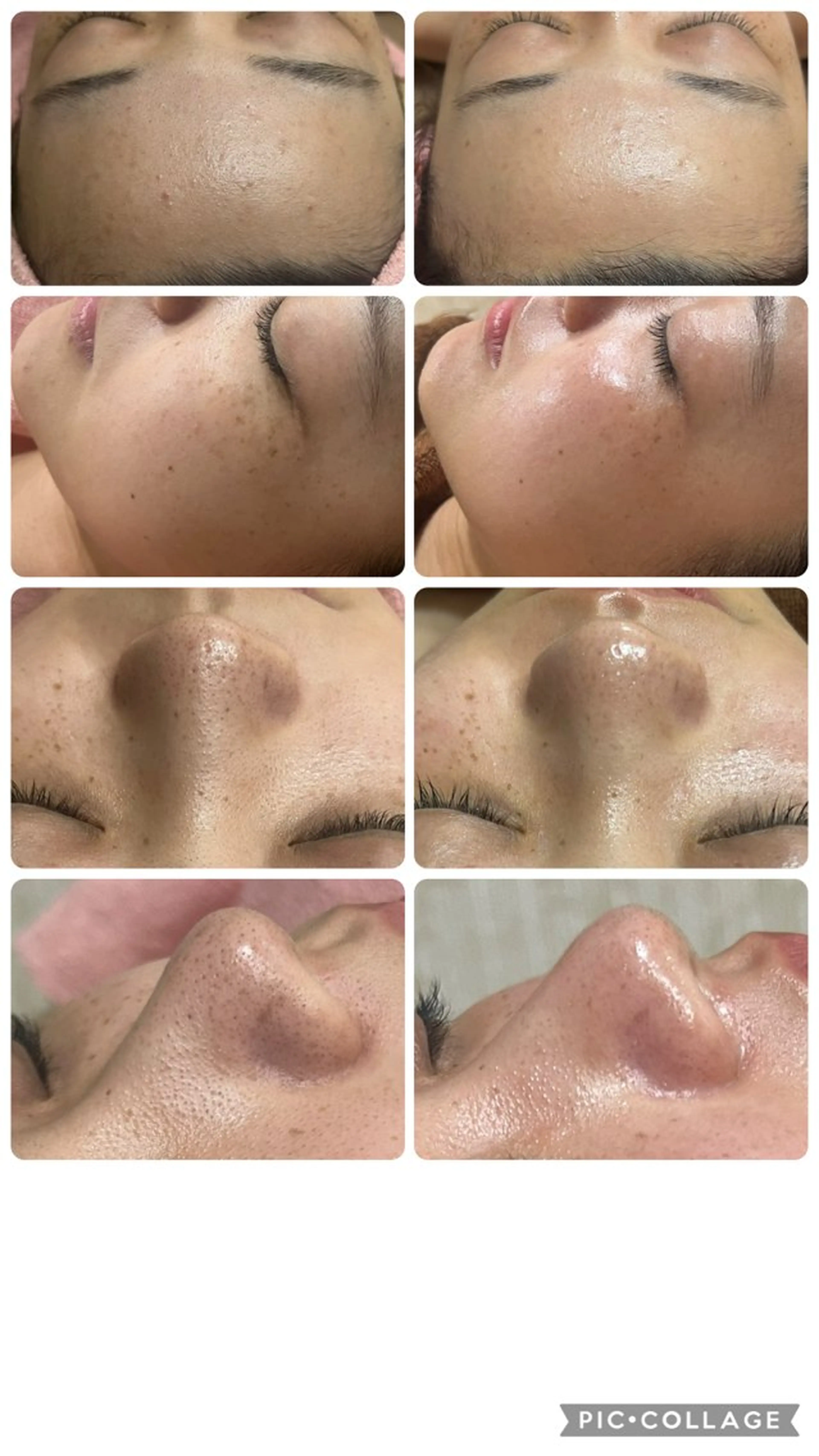 エステ フェイシャル/脱毛 ジョアアンジェ竹田のエステ・リラクイメージ