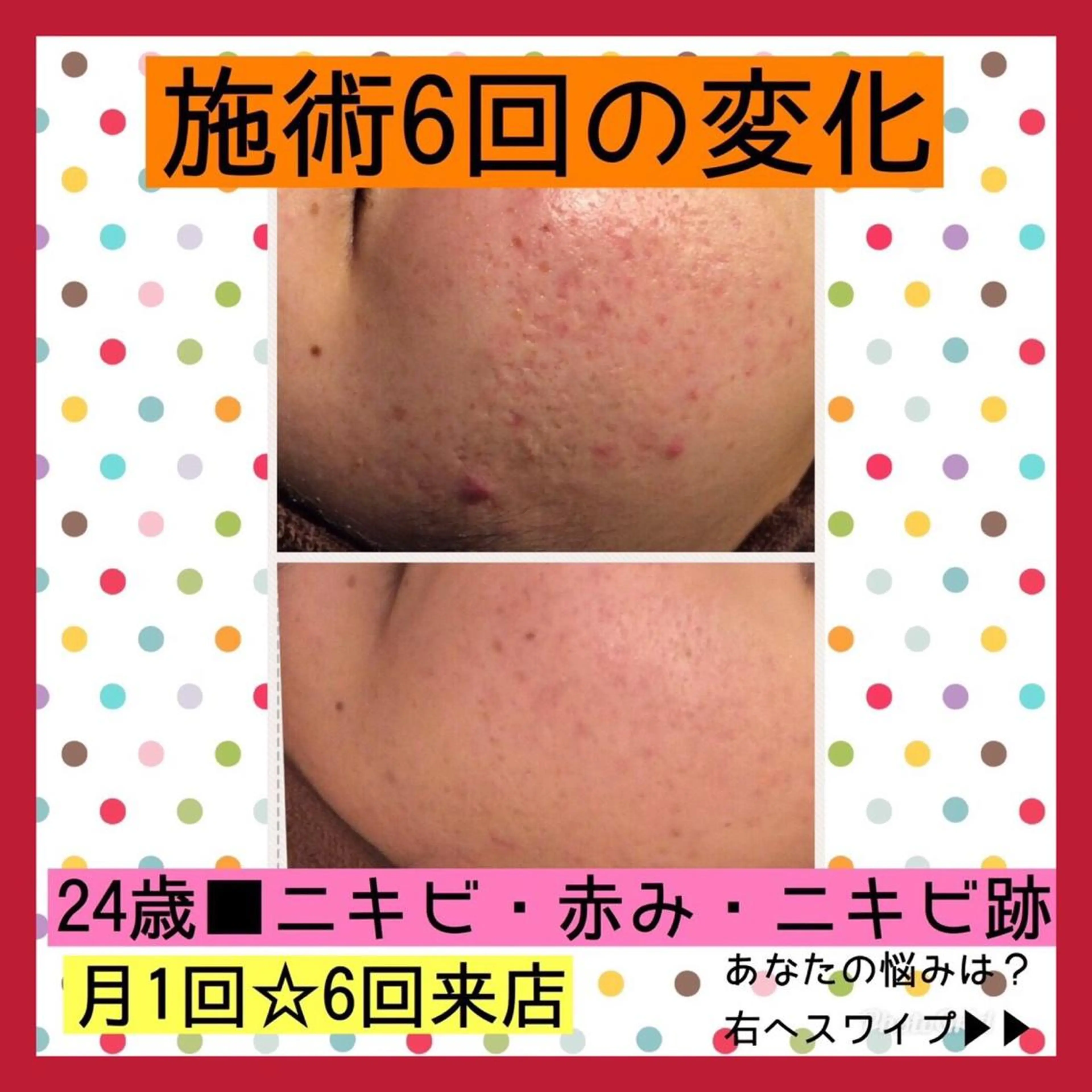 ミディアム カラー パーマ ヘアアレンジ メンズ キッズ ネイル マツエク・マツパ エステ リラク ニキビ・肌質改善専門 ♡人生が変わるサロンのエステ・リラクイメージ