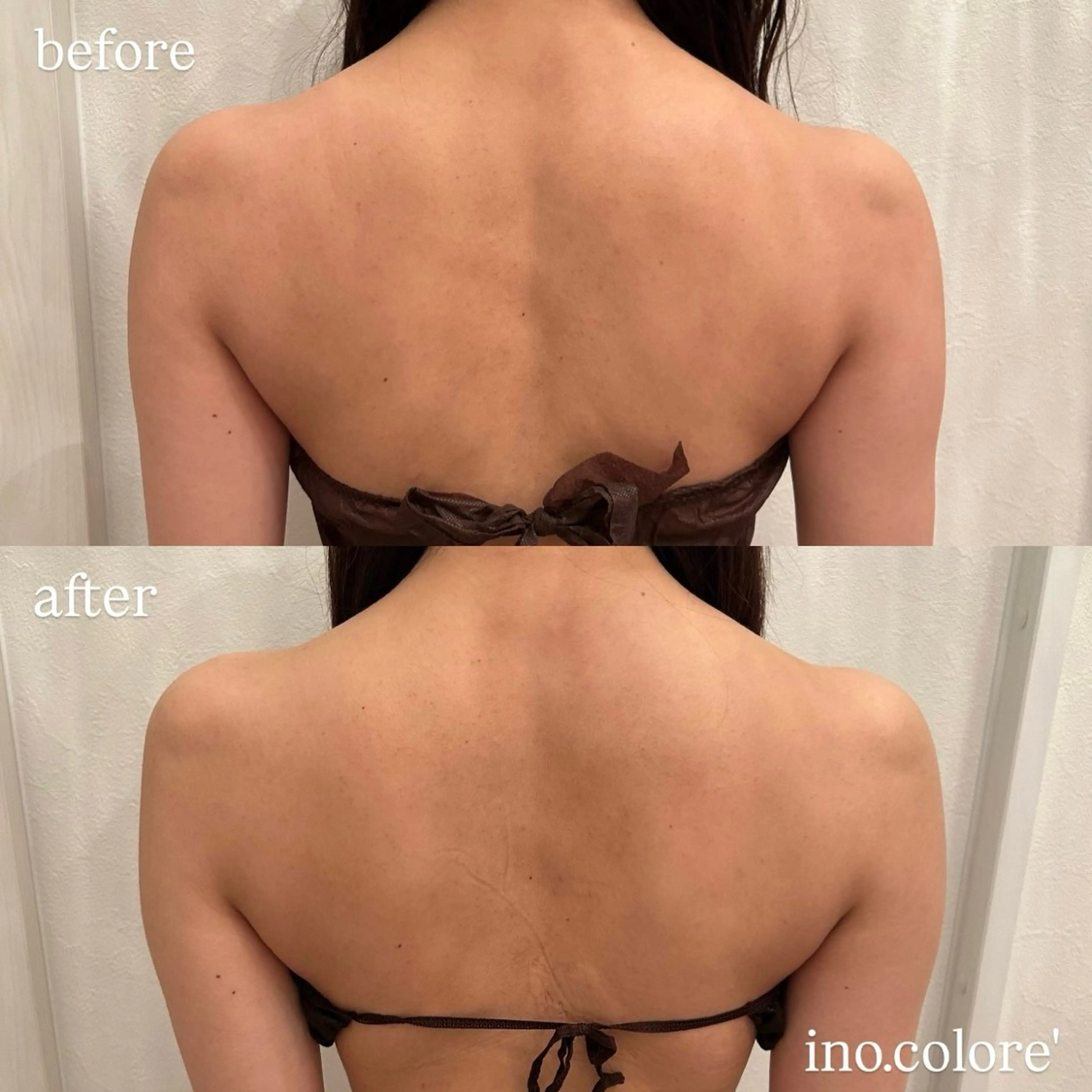 エステ リラク エステサロンino.colore'所属・小顔サロン ino.coloreのエステ・リラクイメージ