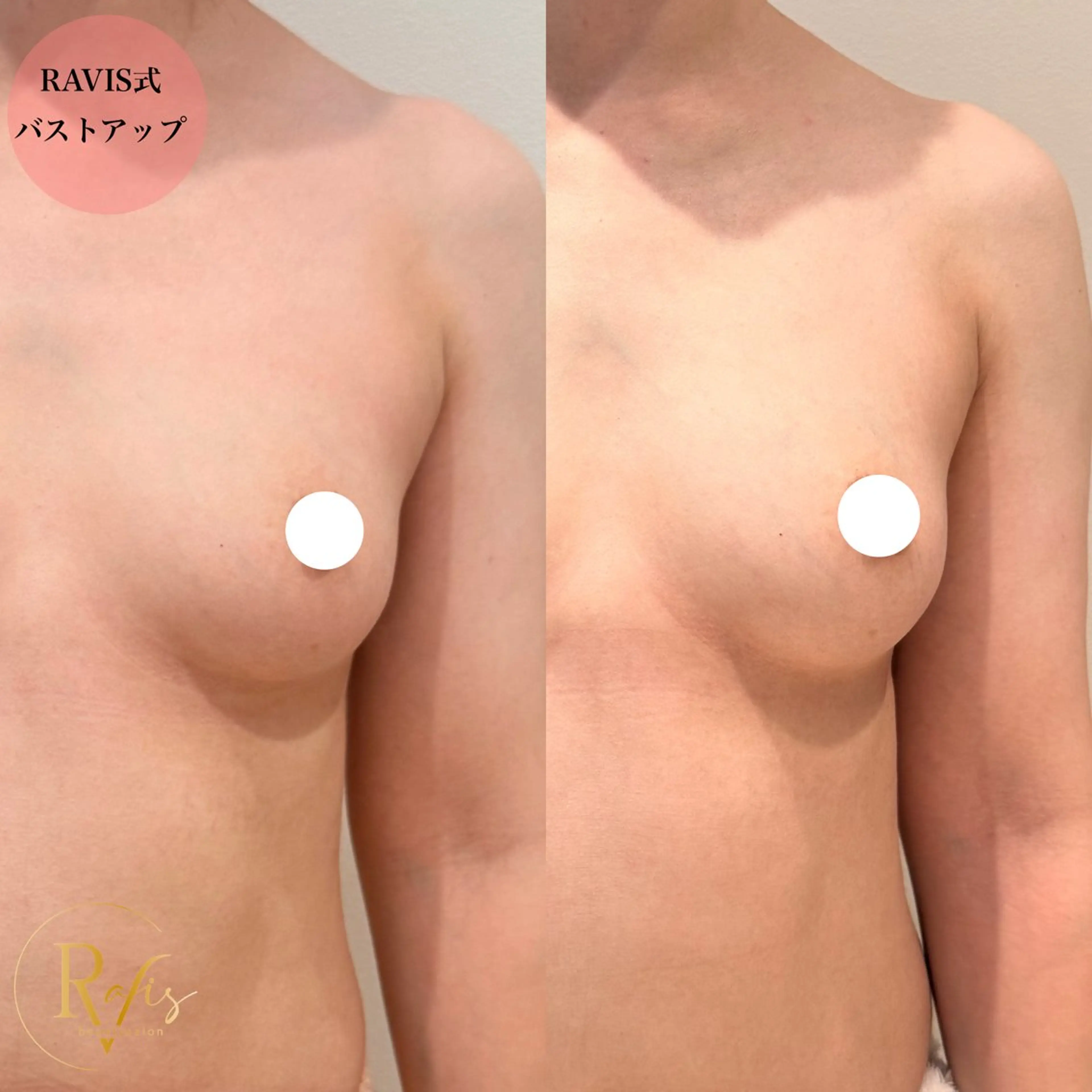 エステ beautysalon RAVIS所属・東大阪/韓国肌管理/ 痩身バスト専門店のエステ・リラクイメージ