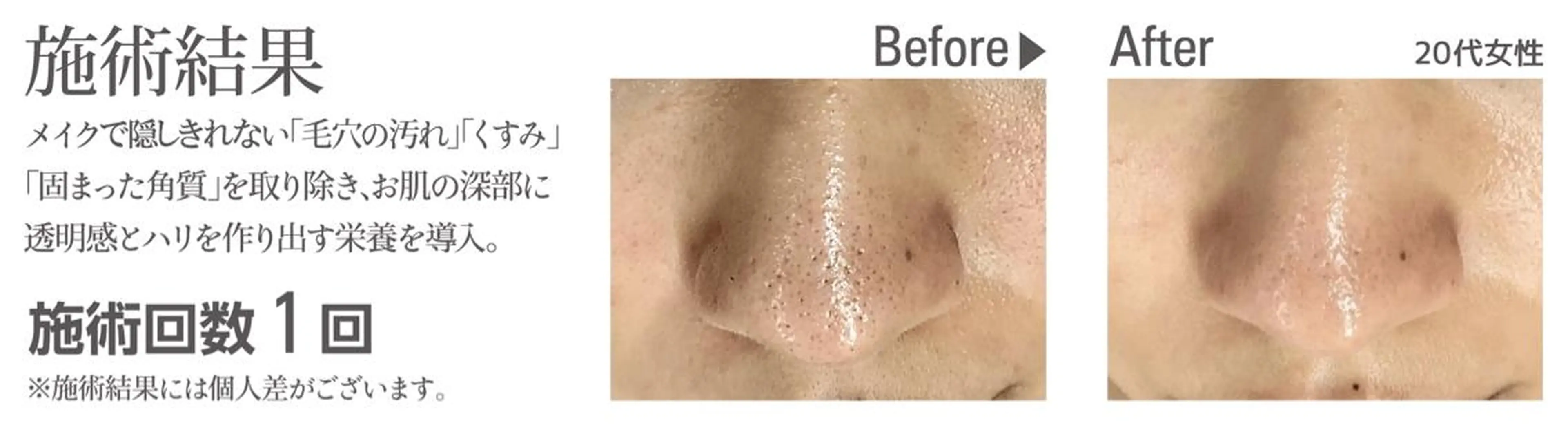 エステ オーガニック エステ サロンフィオーレの眉毛・アイブロウイメージ