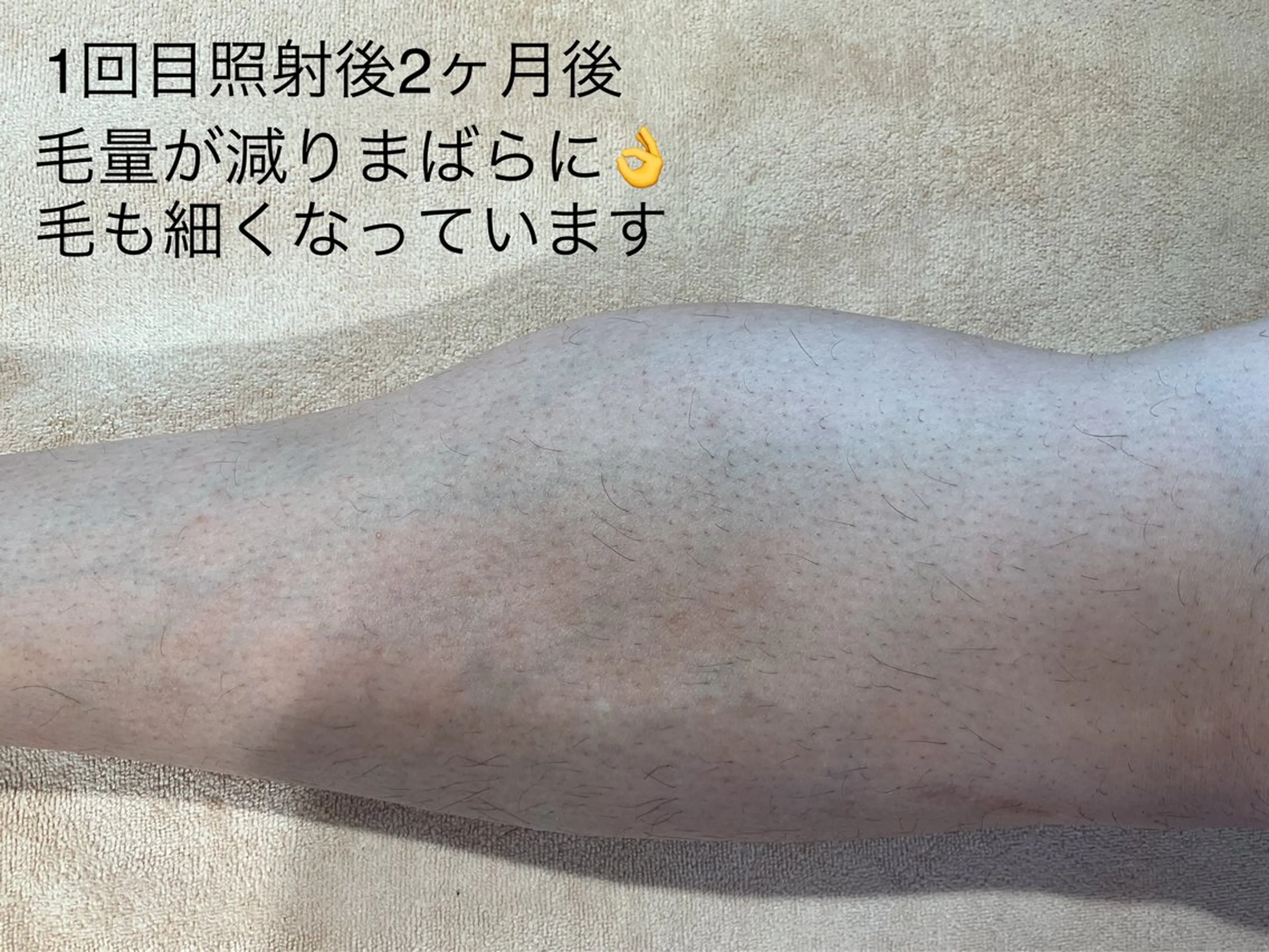 Beauty salon dessert（ビューティーサロンデザート）所属・板垣 あゆみのエステ・リラクイメージ