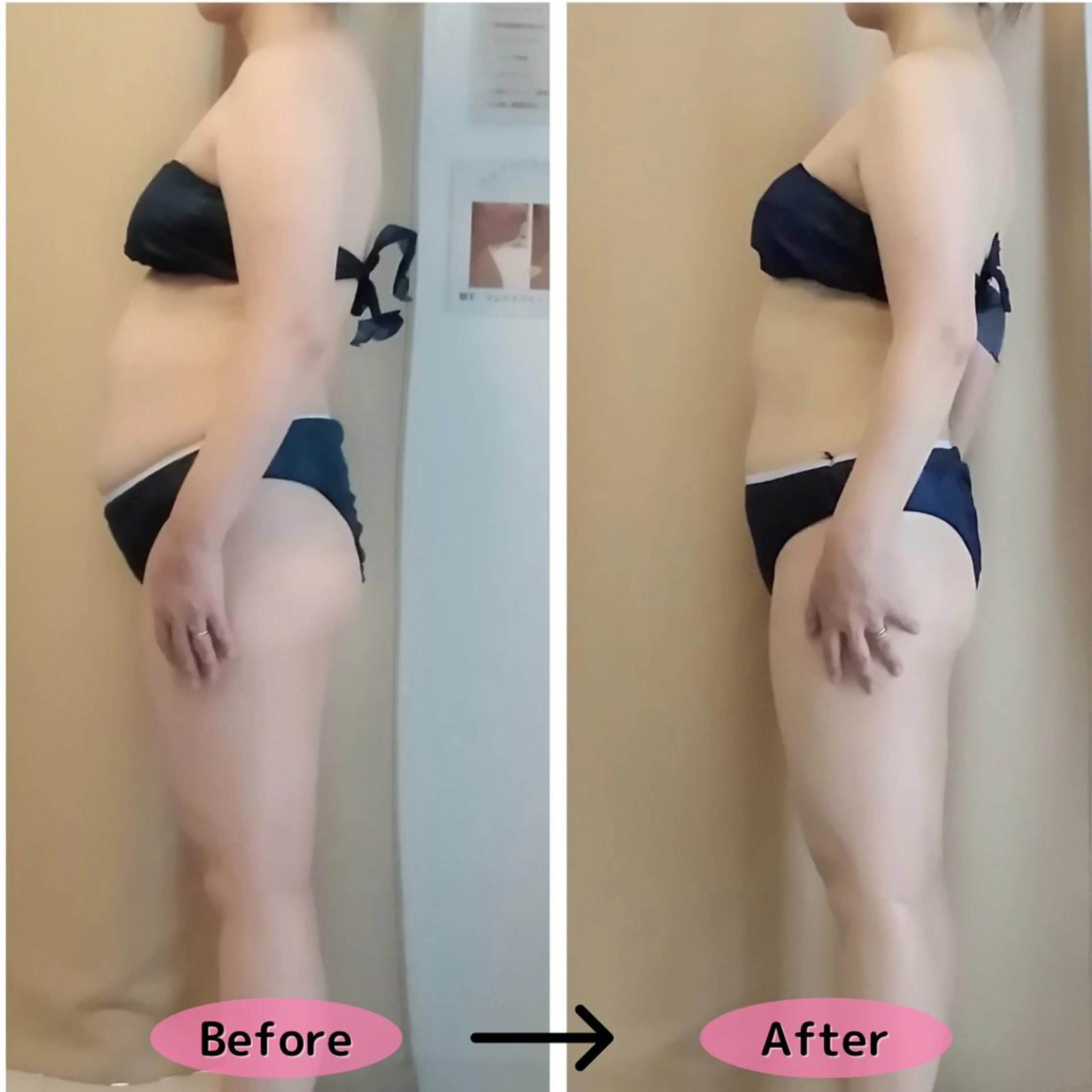 【人気No.1】本気痩せ🔥全身痩身90分▶23,100円→8,680円✨の写真