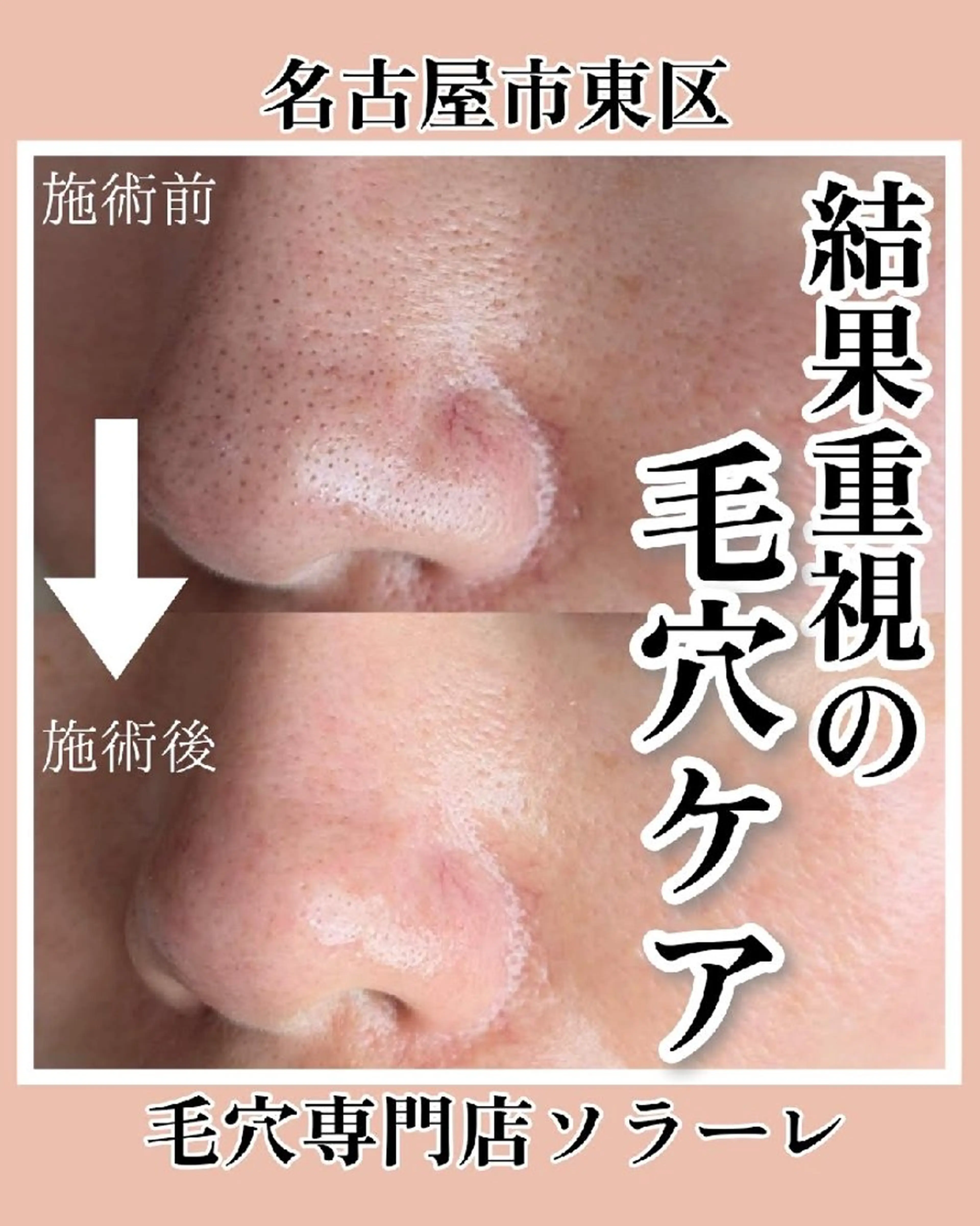  毛穴洗浄・まつ毛 の専門店 ソラーレのエステ・リラクイメージ