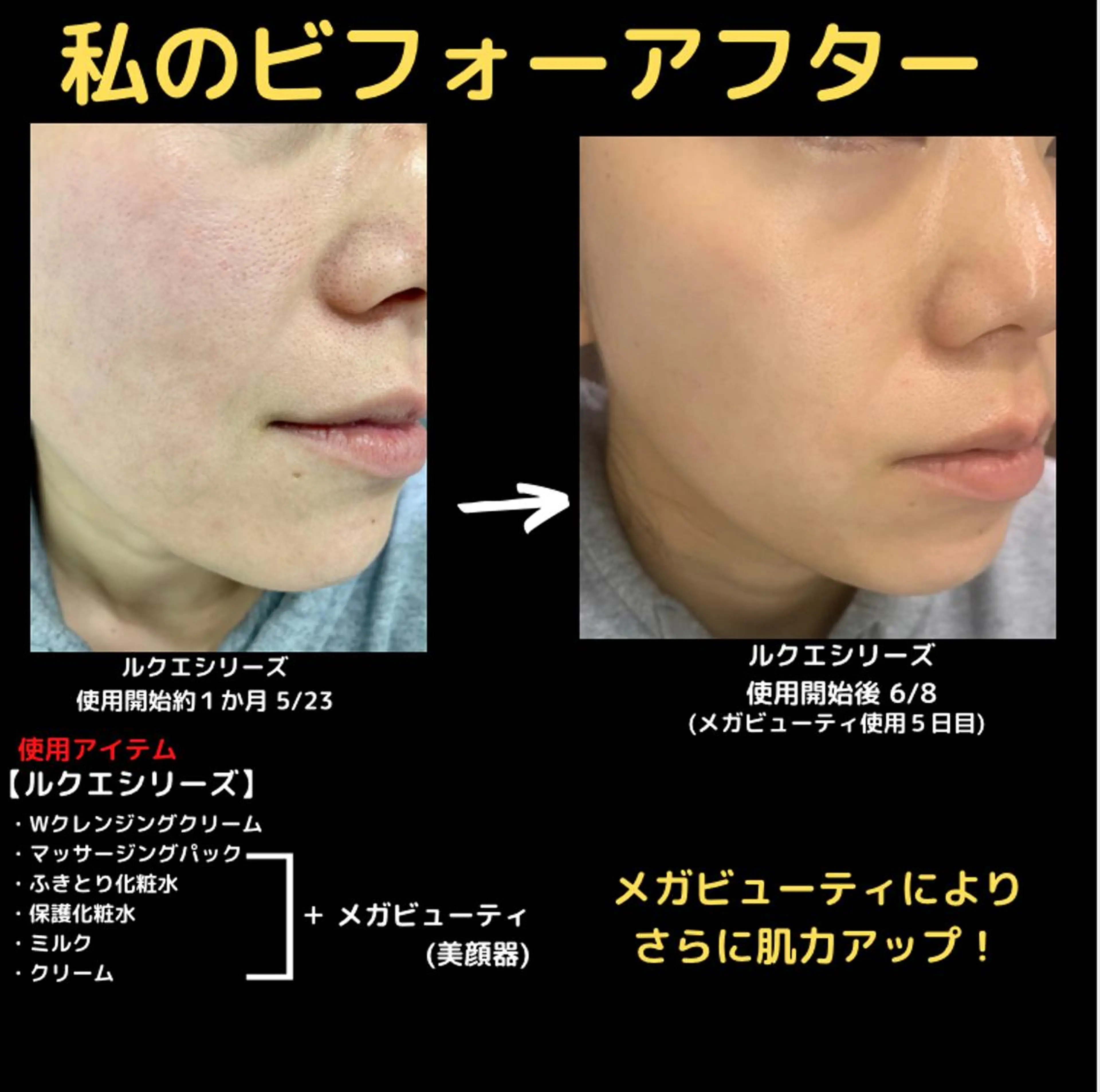 ミューズエステ 谷口美結のエステ・リラクイメージ