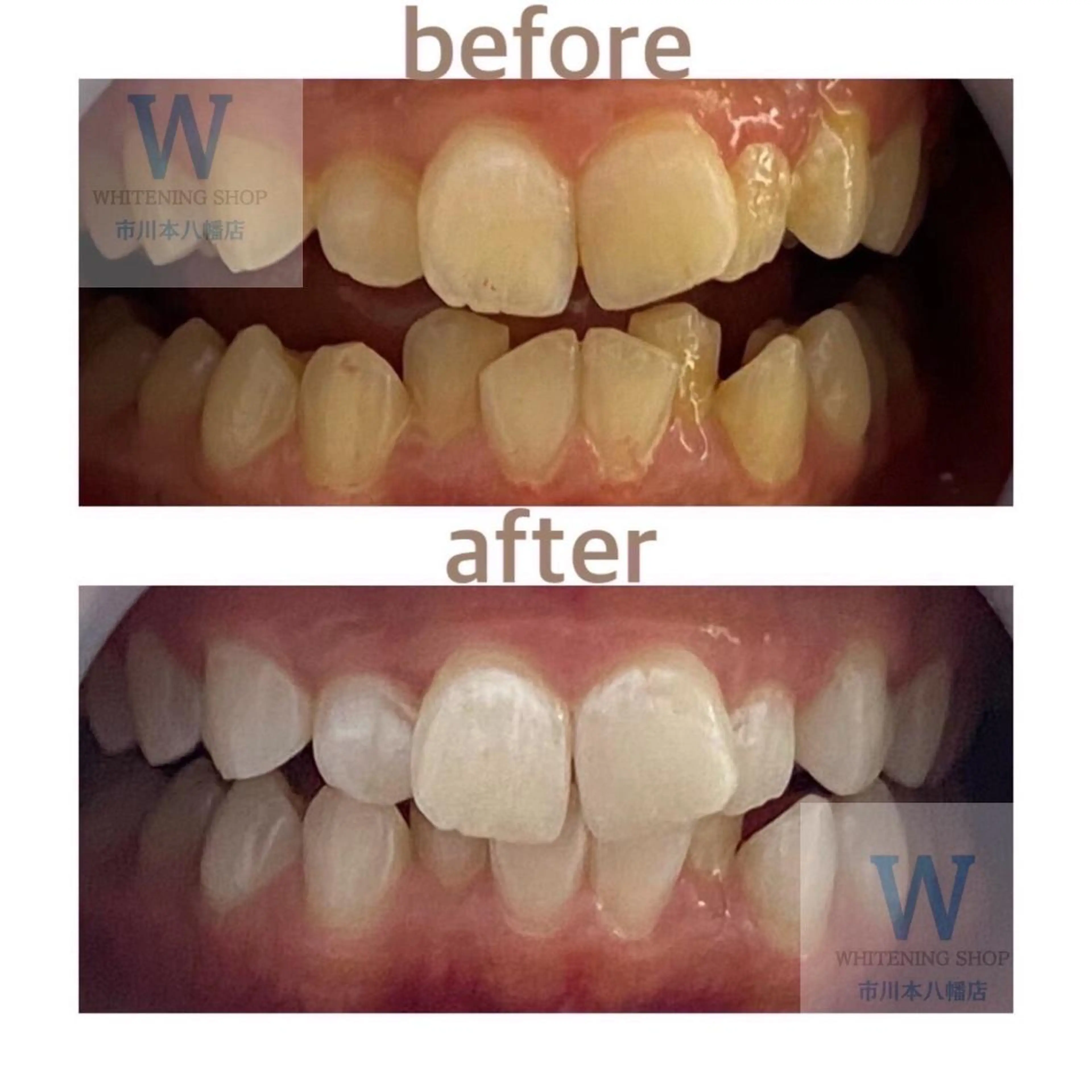 ホワイトニング ショップ本八幡店のエステ・リラクイメージ