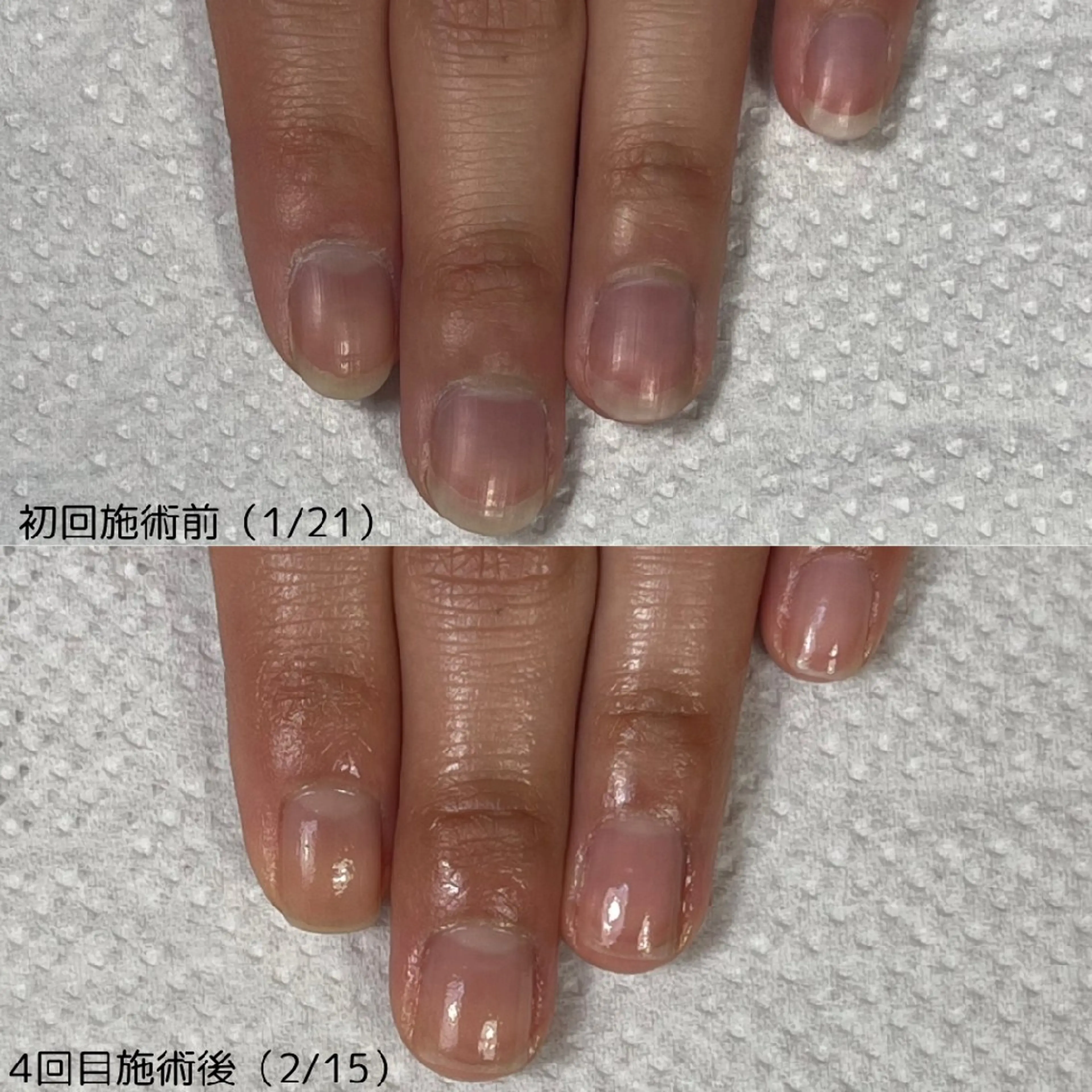 ネイル nail 1623のネイルデザイン