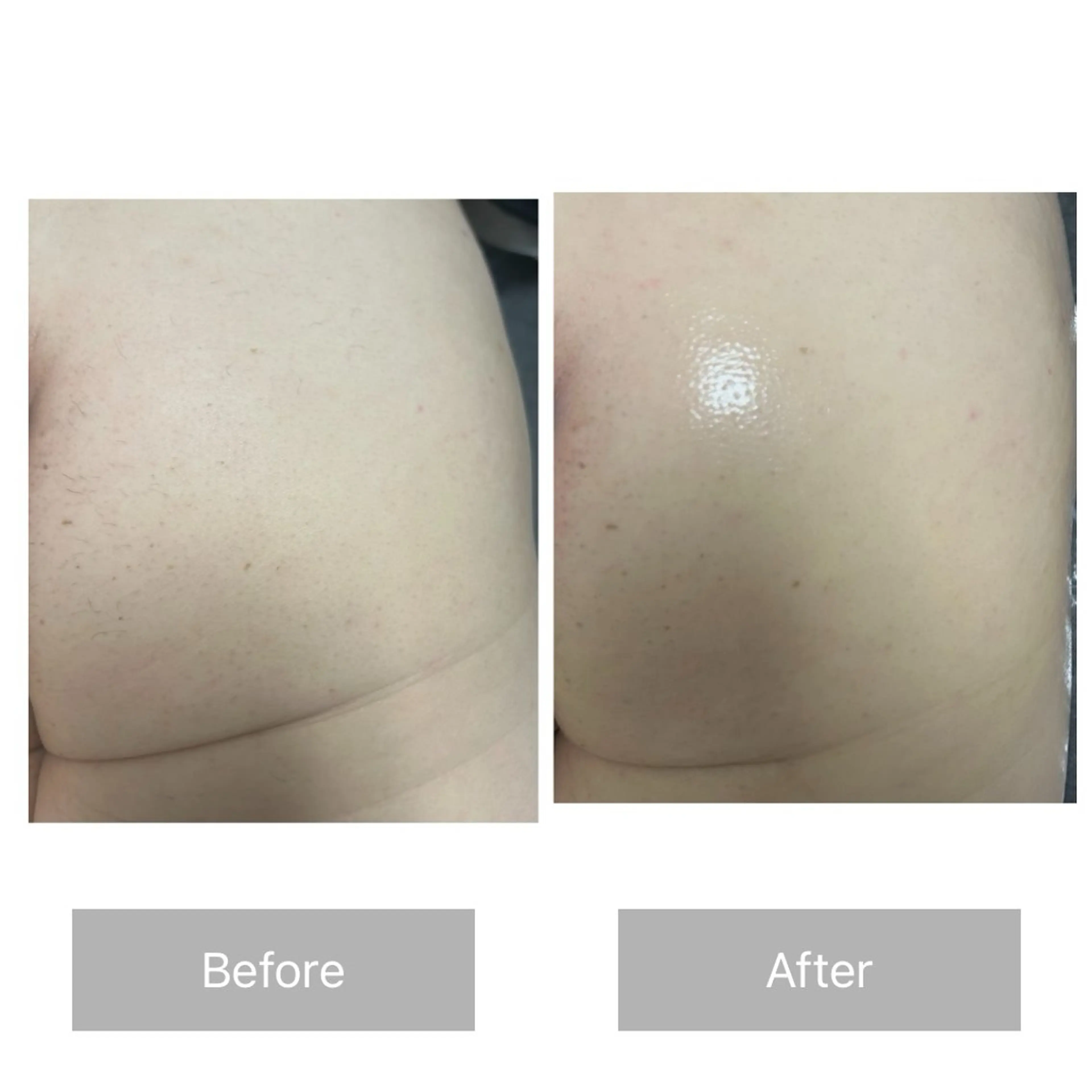 メンズ エマニエル USAのエステ・リラクイメージ