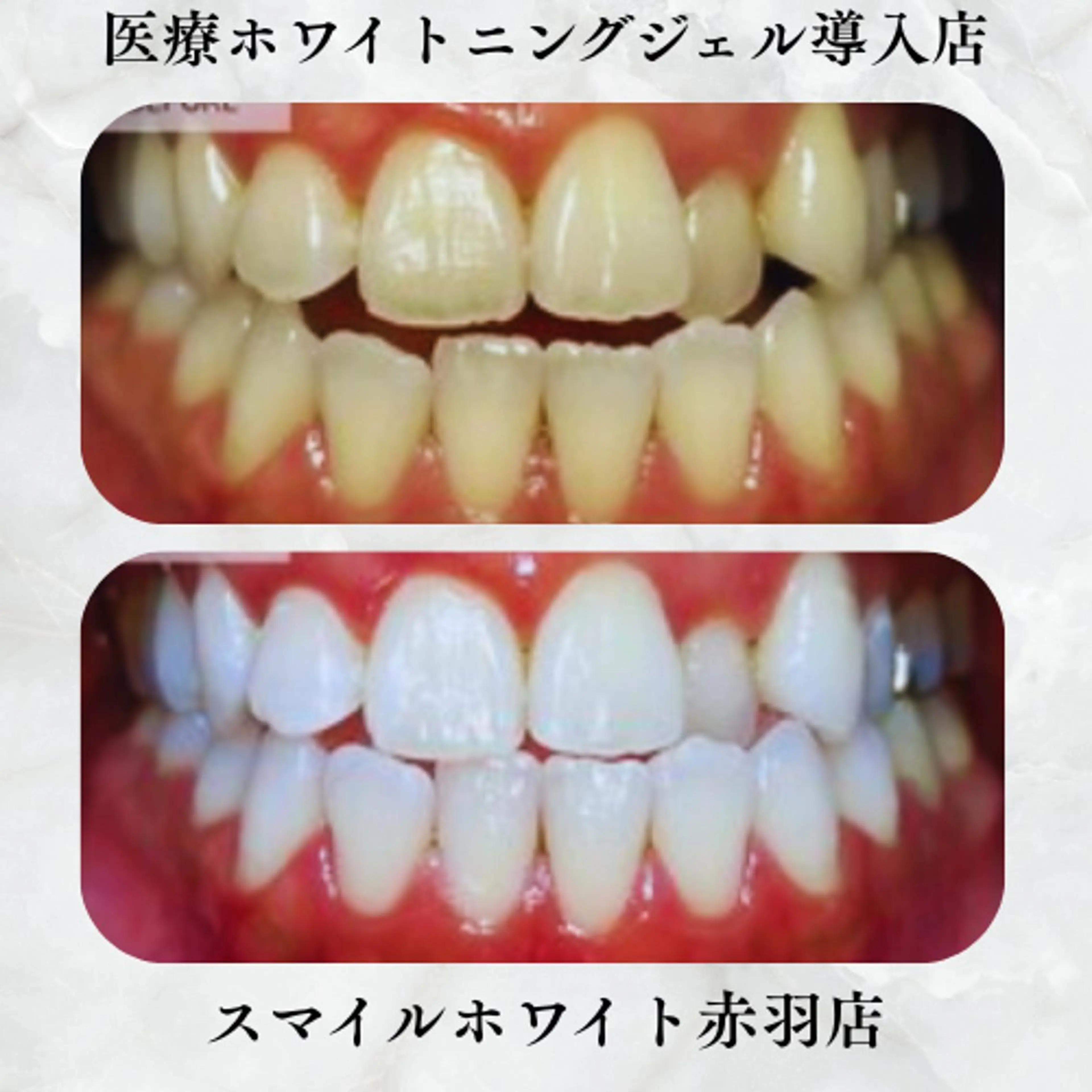 ネイル 赤色 ホワイト スマイルホワイト 赤羽店のエステ・リラクイメージ