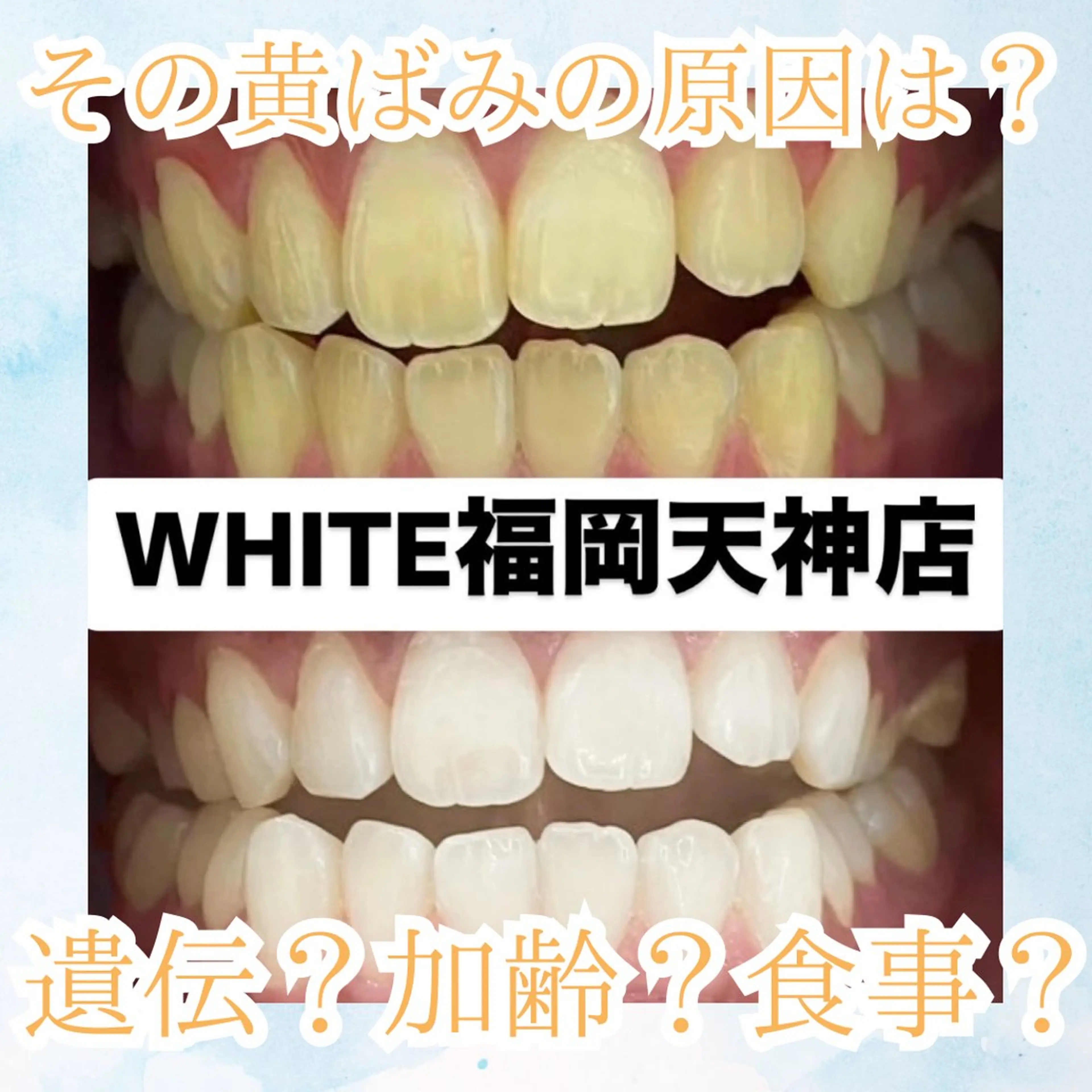メンズ エステ リラク ホワイトニング専門店 WHITE天神店のエステ・リラクイメージ