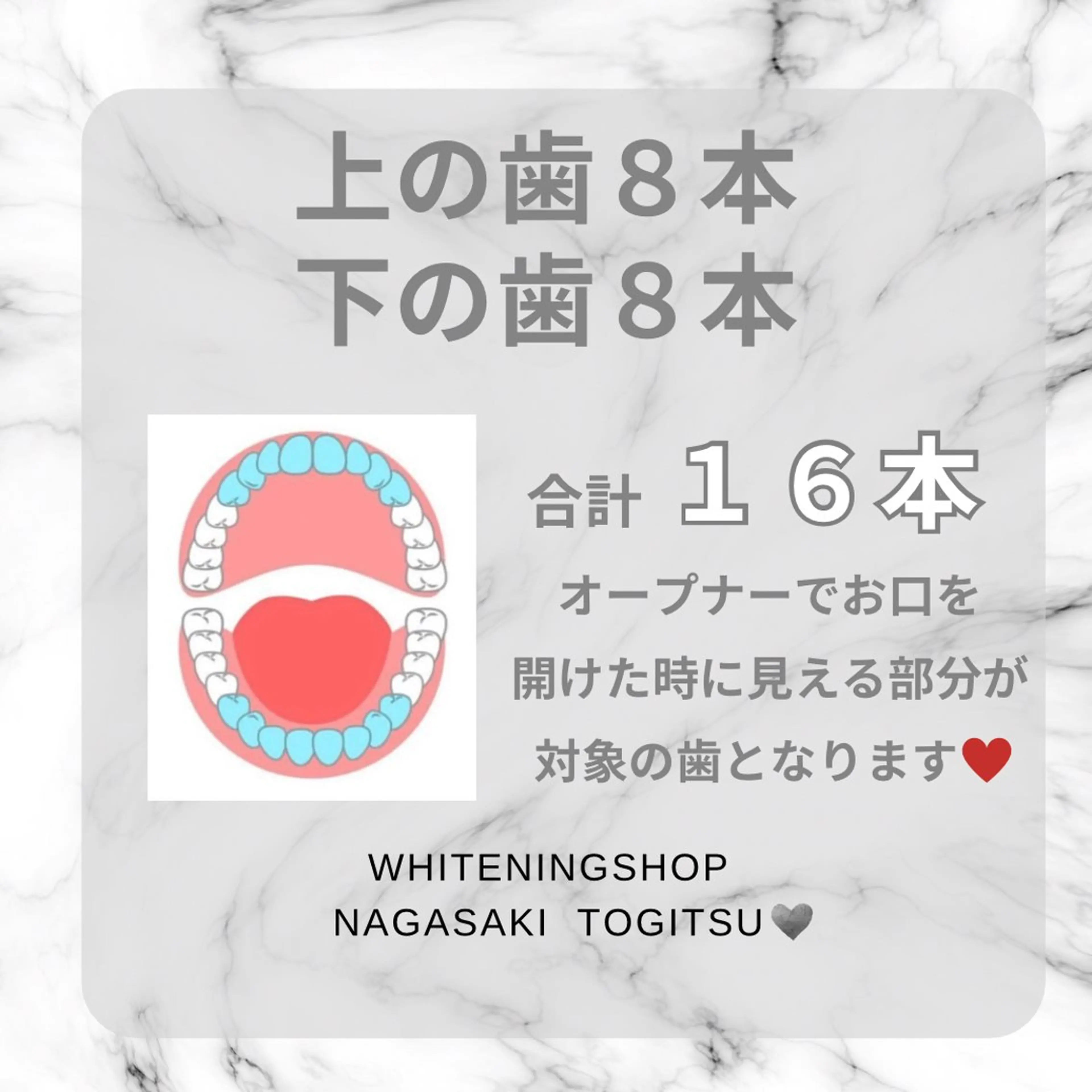 ホワイトニングショップ時津店所属・ホワイトニング ショップ長崎時津店のその他イメージ