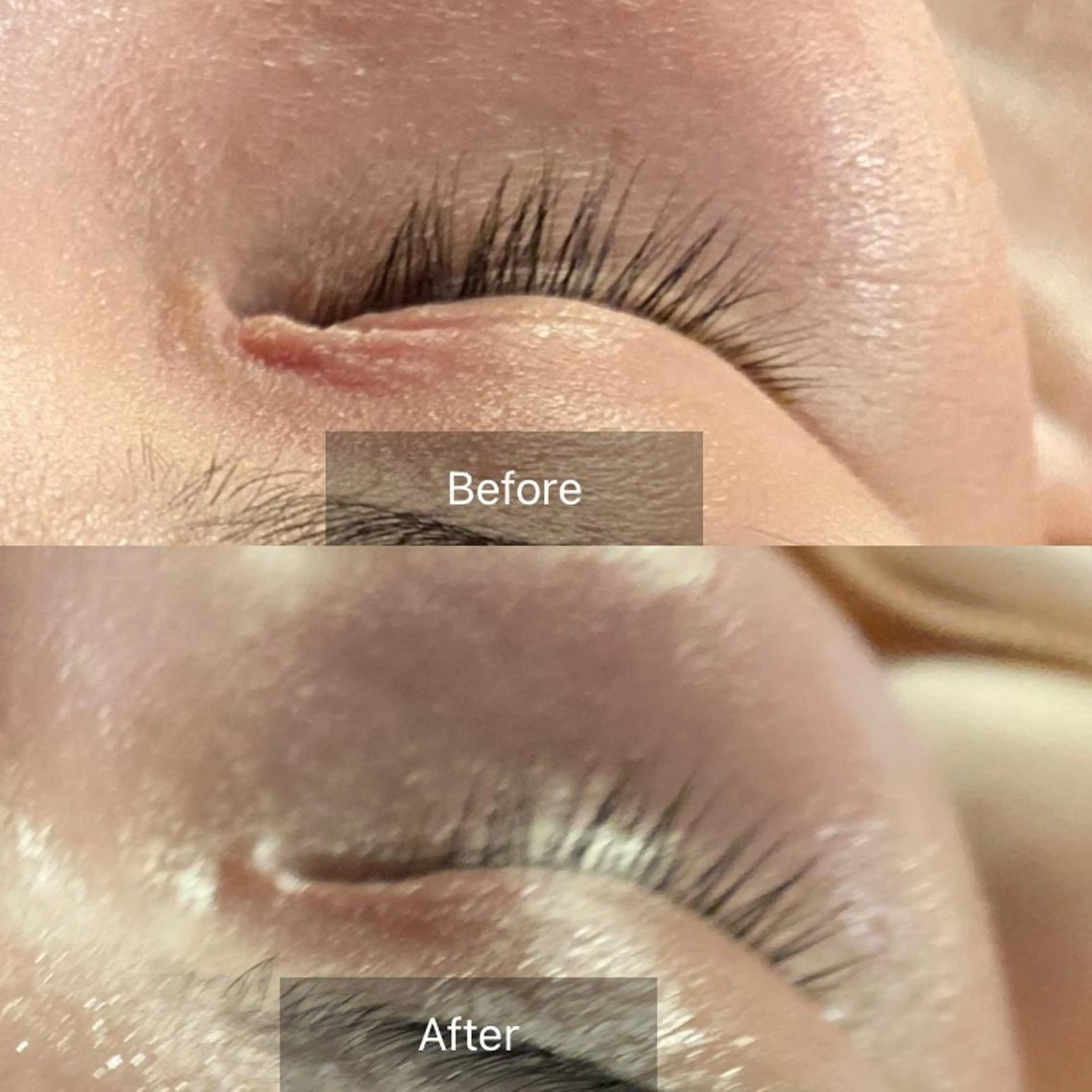 Mandarin Orange所属・毛穴から始める肌メン テマンダリンオレンジのエステ・リラクイメージ