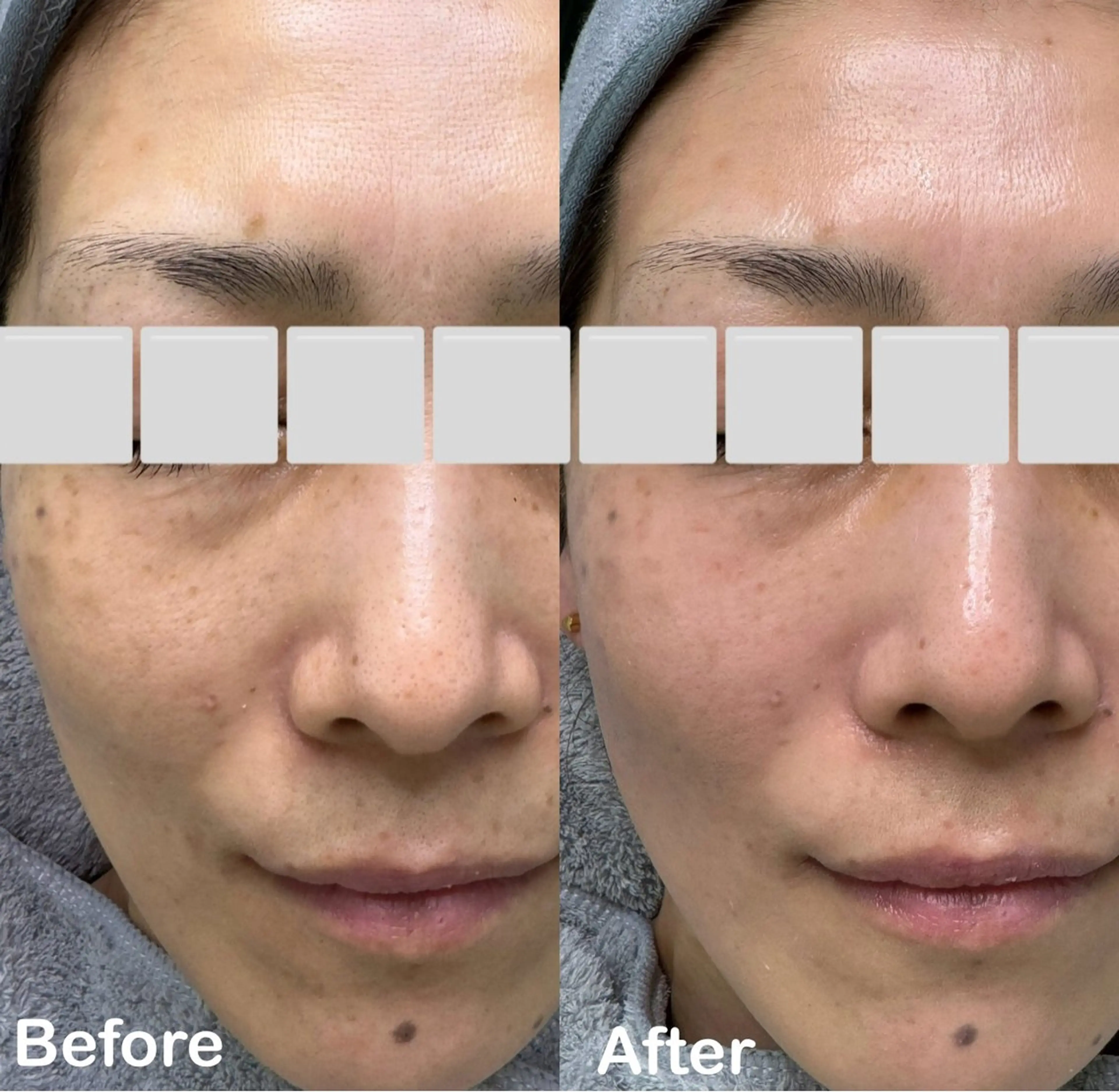 アイラッシュ＆フェイシャルサロン　ベアトリーチェ所属・医療提携美容サロン Beatriceのエステ・リラクイメージ