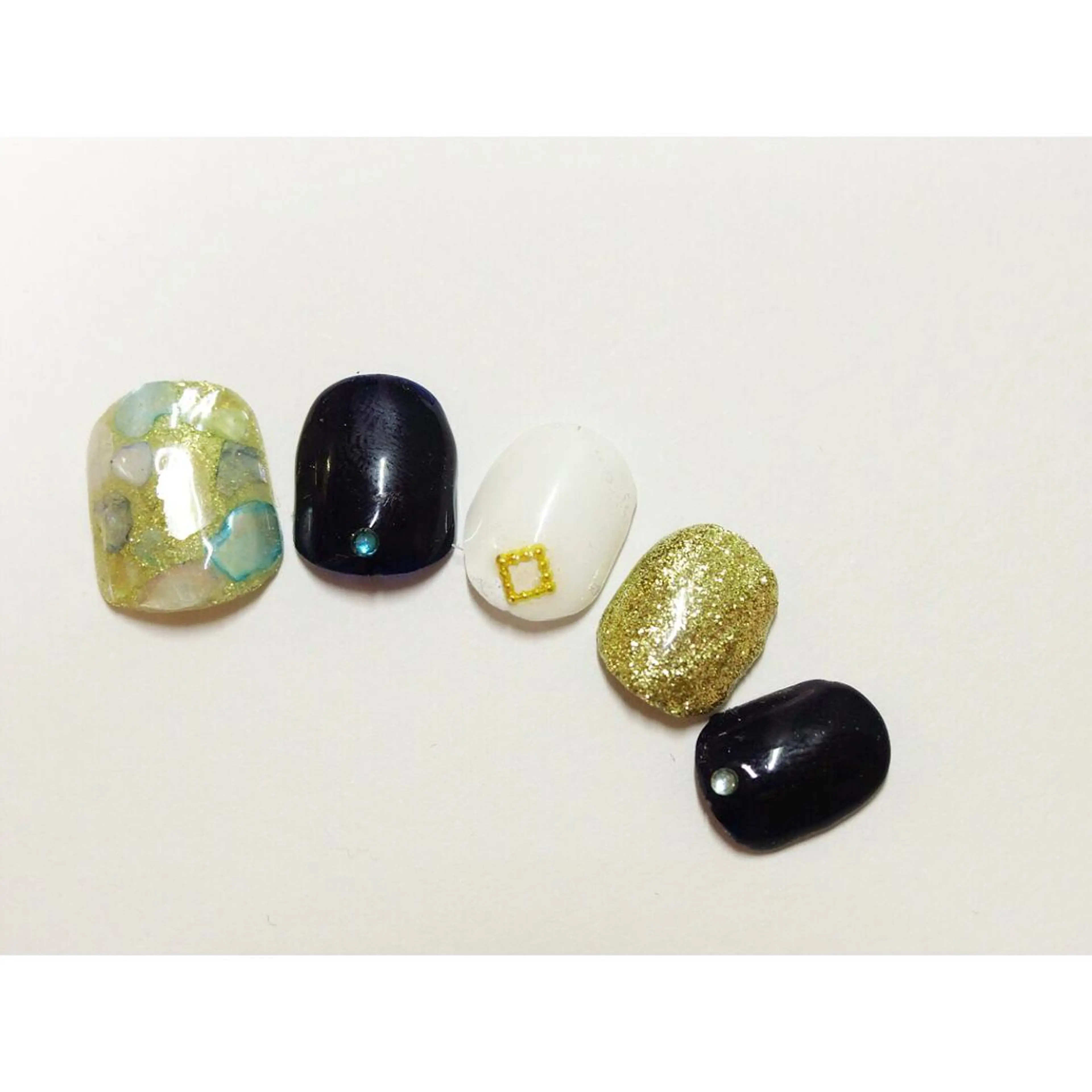 ネイル フットネイル 痛ネイル/ワンホン/ フィルイン/長さだしのネイルデザイン