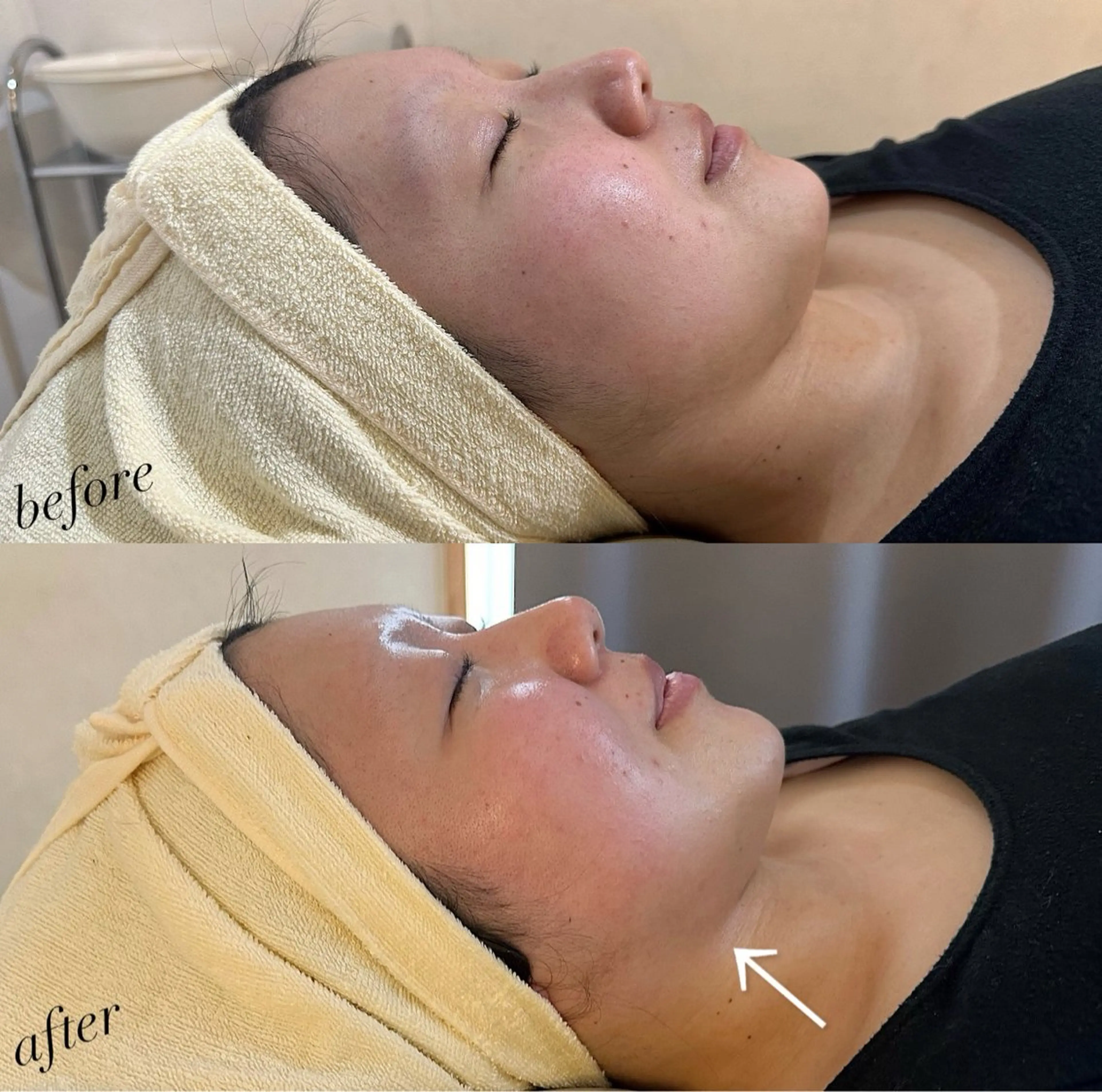 うなじ脱毛/美肌脱毛 LABELのエステ・リラクイメージ