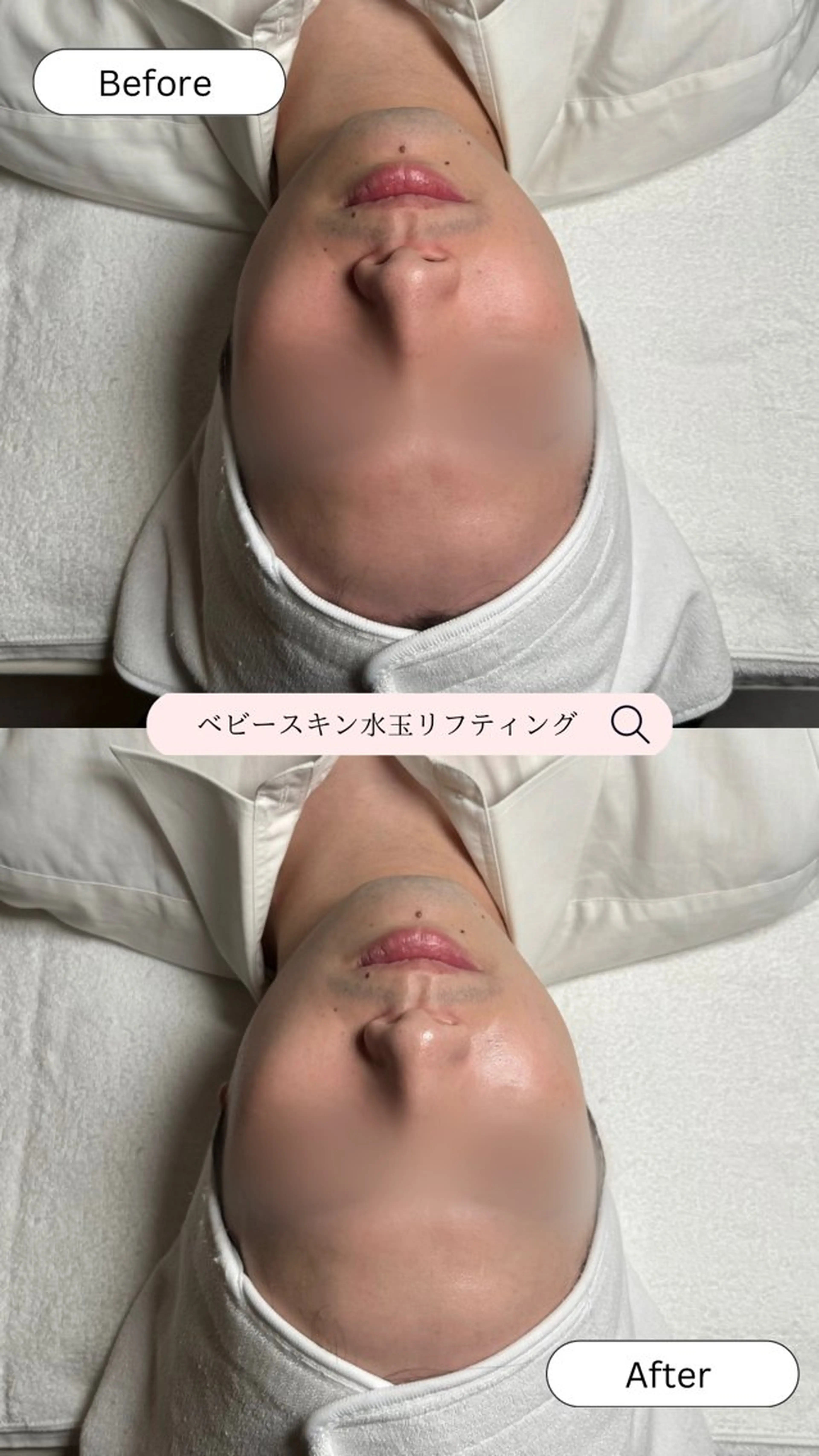 韓国肌管理🫧LDM 🫧Junnaのエステ・リラクイメージ